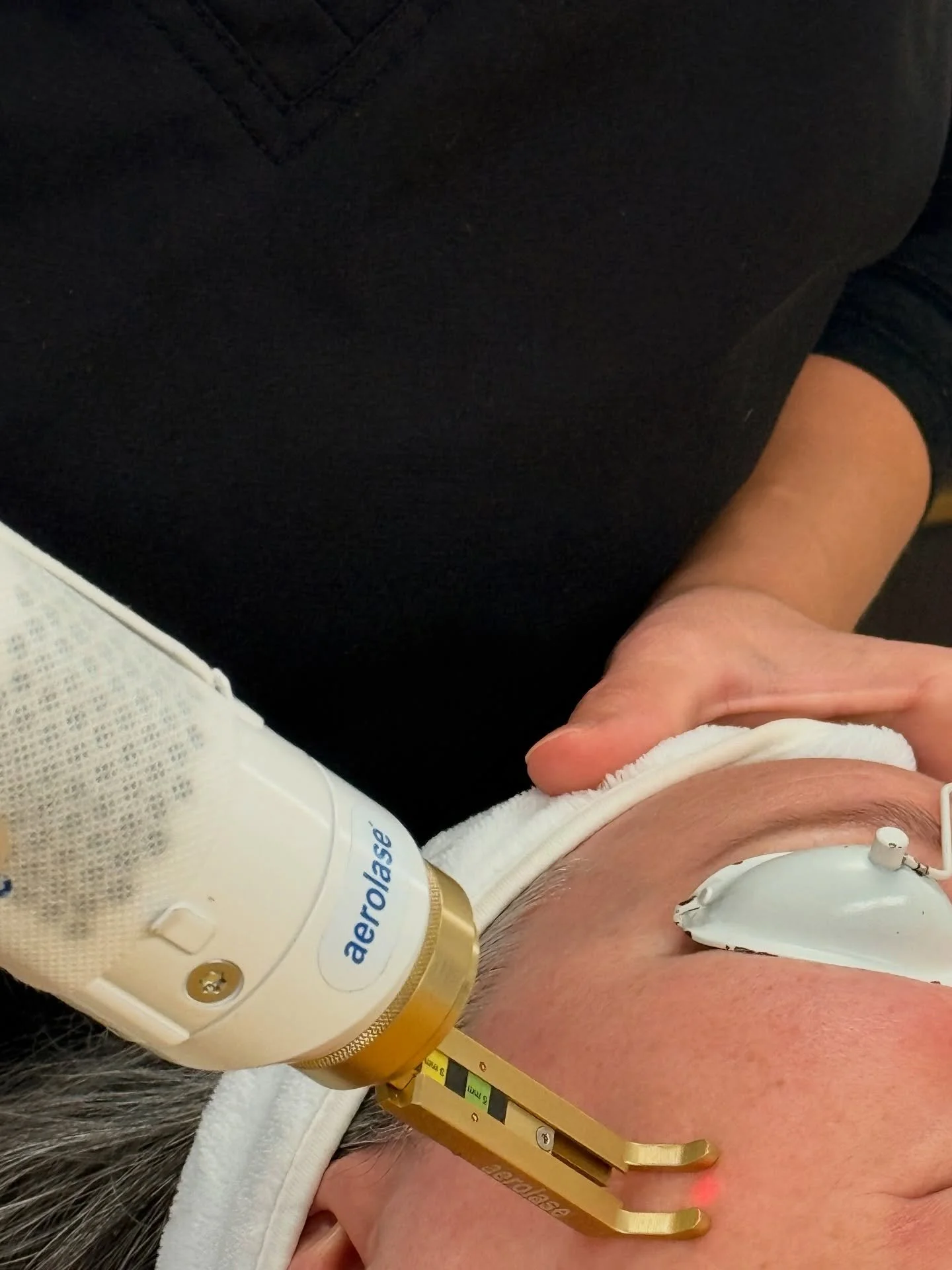 Struggling with acne, dark spots, redness, or texture? Meet Aerolase.

Aerolase is changing the way we treat stubborn skin concerns &mdash; from acne and dark spots to redness, texture, and signs of aging. This gentle, no-downtime laser is safe for e