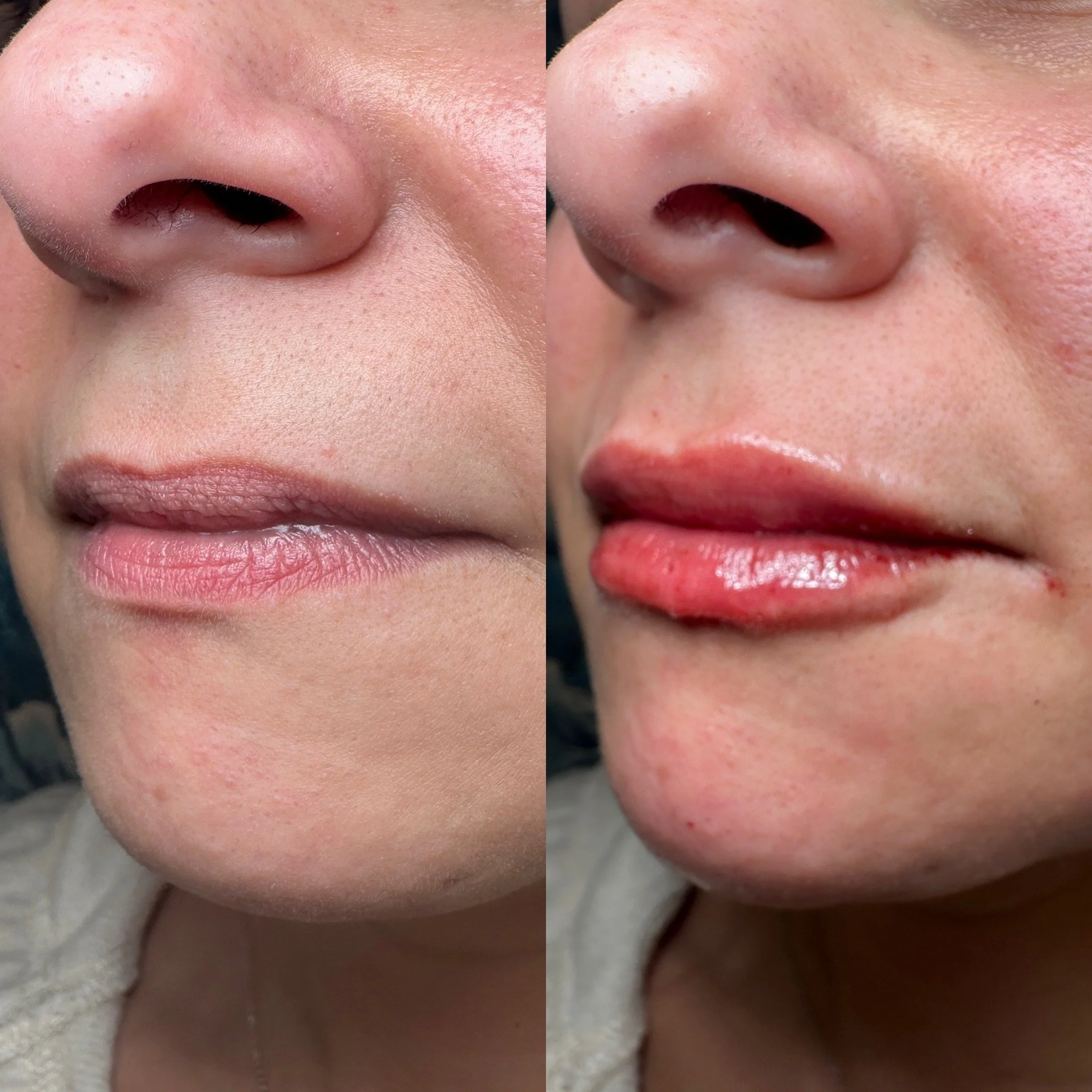 A side-by-side comparison of a person's face, focusing on the nose and lips. The left side shows natural lips, while the right side shows lips with glossy, pinkish lipstick or gloss applied.