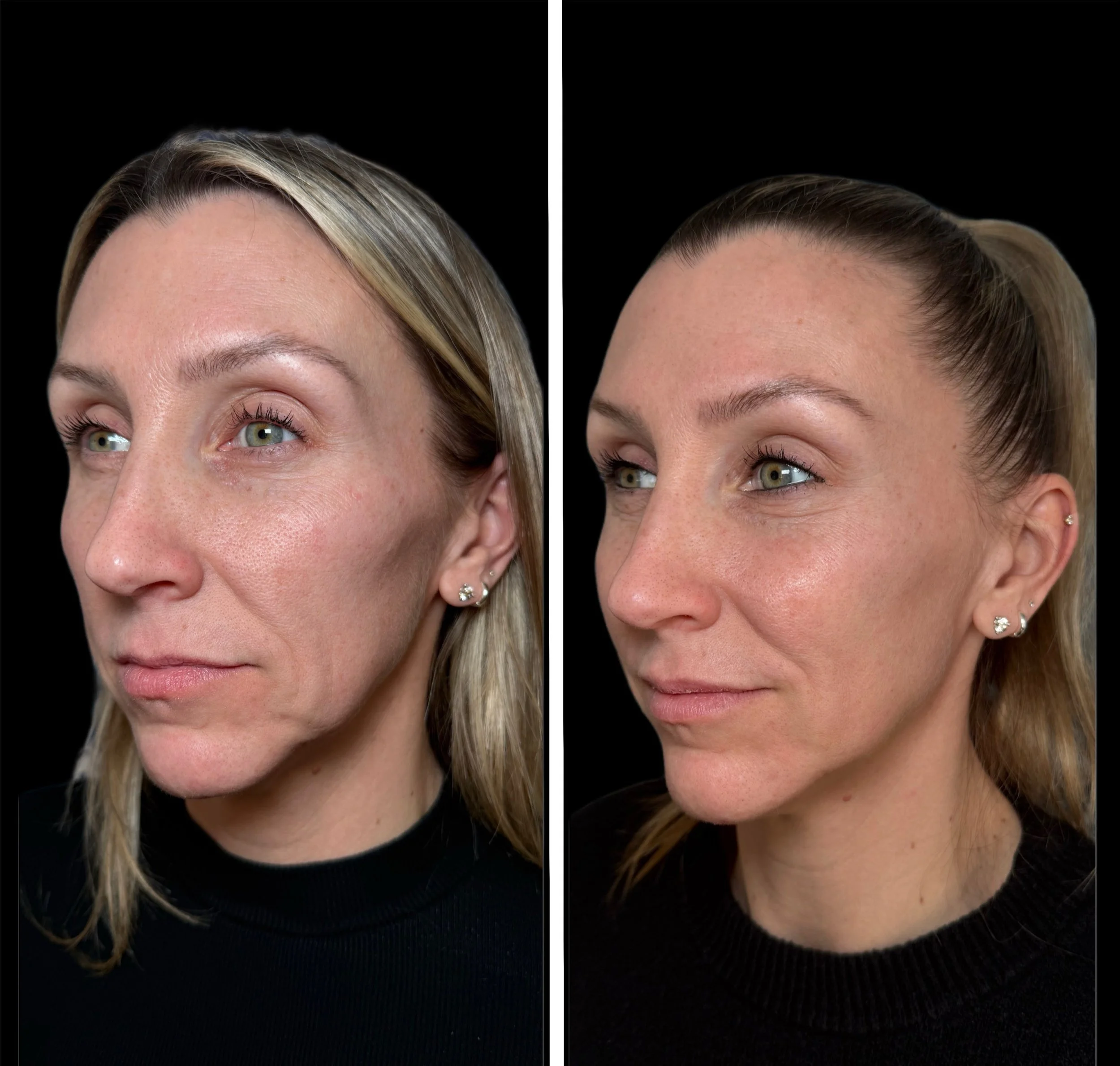 Comparison of two close-up portraits of the same woman with fair skin, green eyes, and earrings, showing different facial textures and skincare results against a black background.