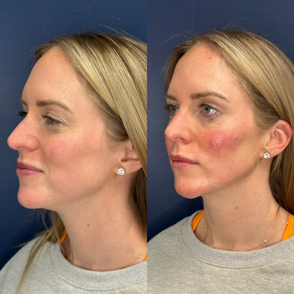 Facial Balancing Ivs By The Seas