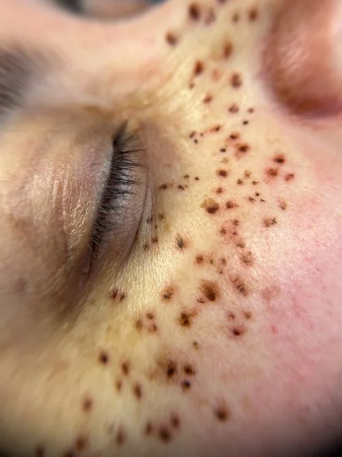 Tattooed freckles on face to create demention.