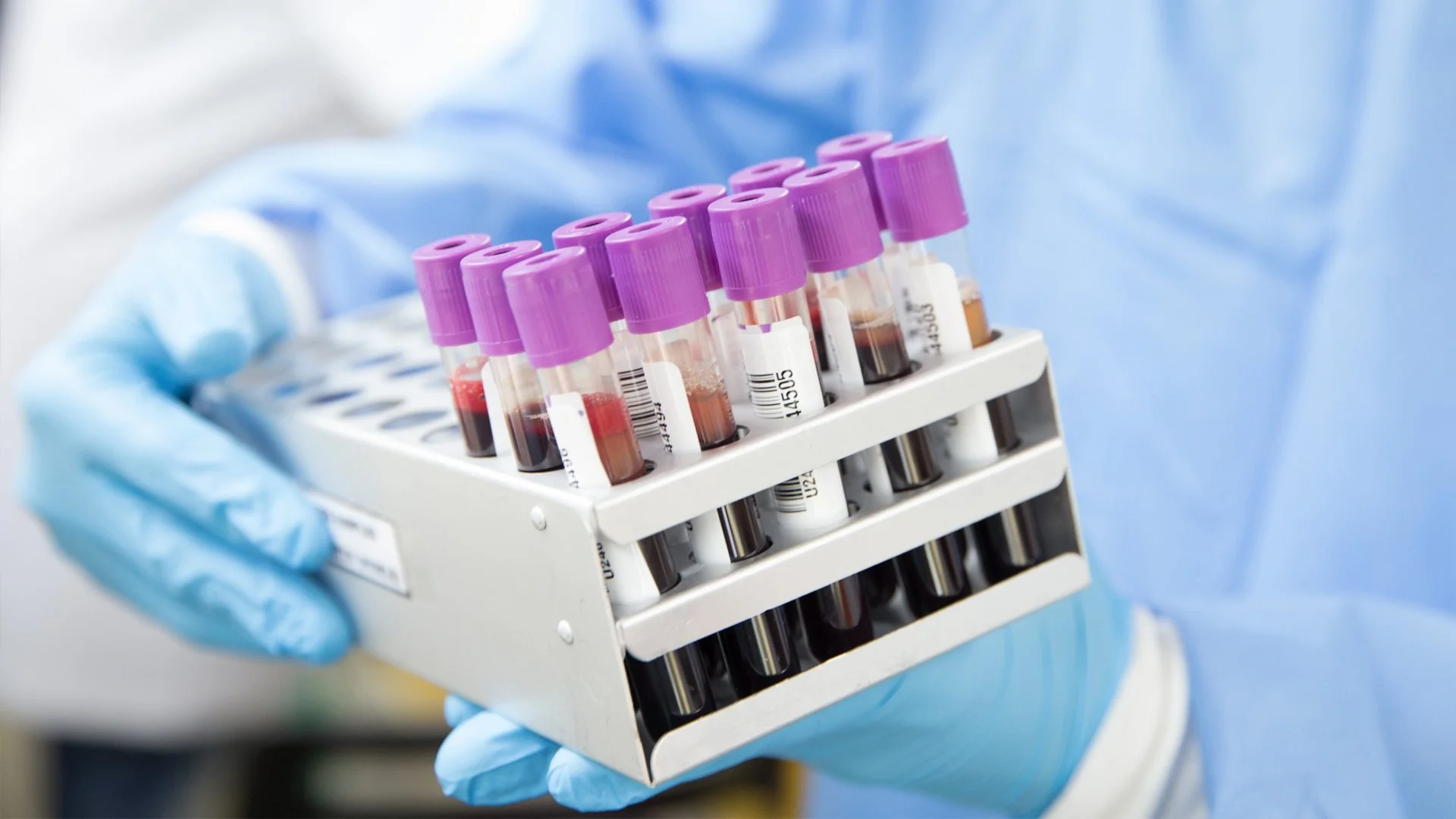 BLOOD TESTS, CANCER, TREATMENT.jpg