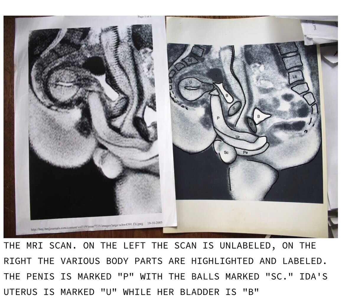 This is the first ever image of a cis-hetero couple shagging in an MRI machine, for science and our curiosities in 1991. Thank you science ❤️&zwj;🔥

These images are sourced from a Vice article about the couple&rsquo;s experience some 30 years ago.
