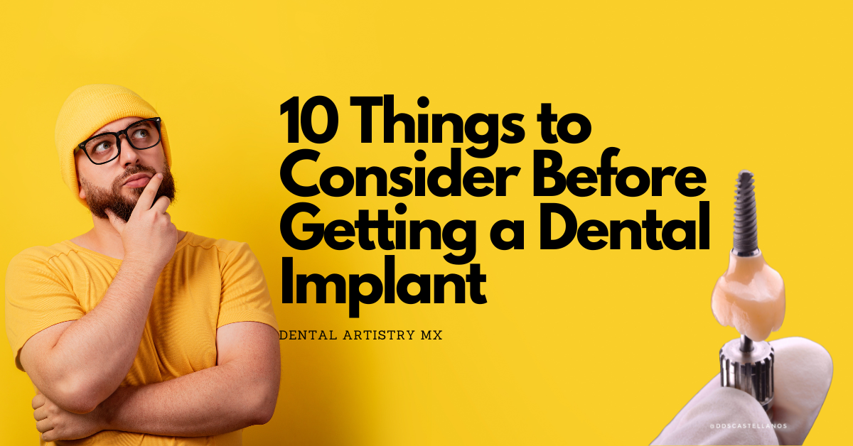 10 Things to Consider Before Getting a Dental Implant.