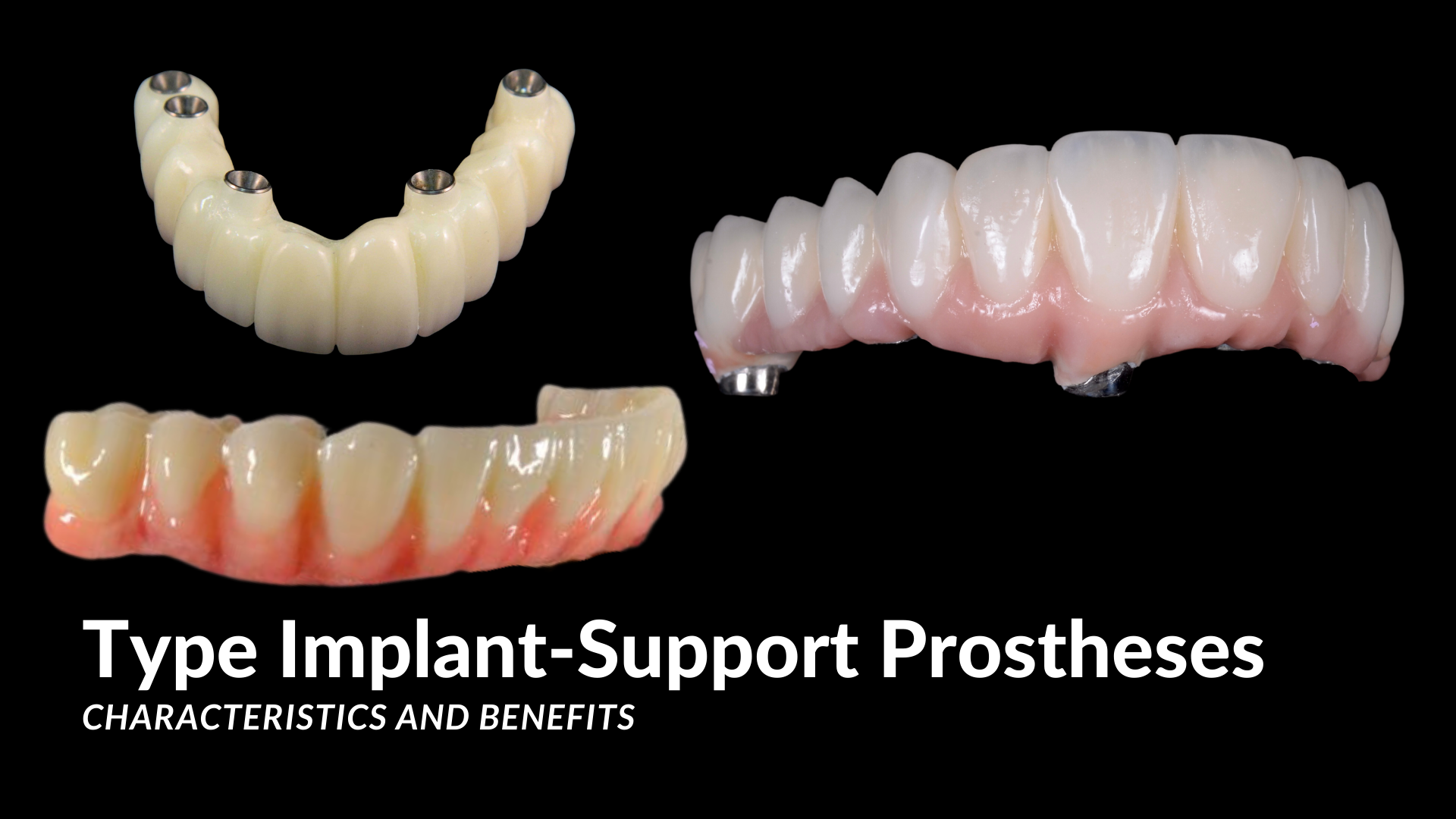 Type of Dental Implants Denture