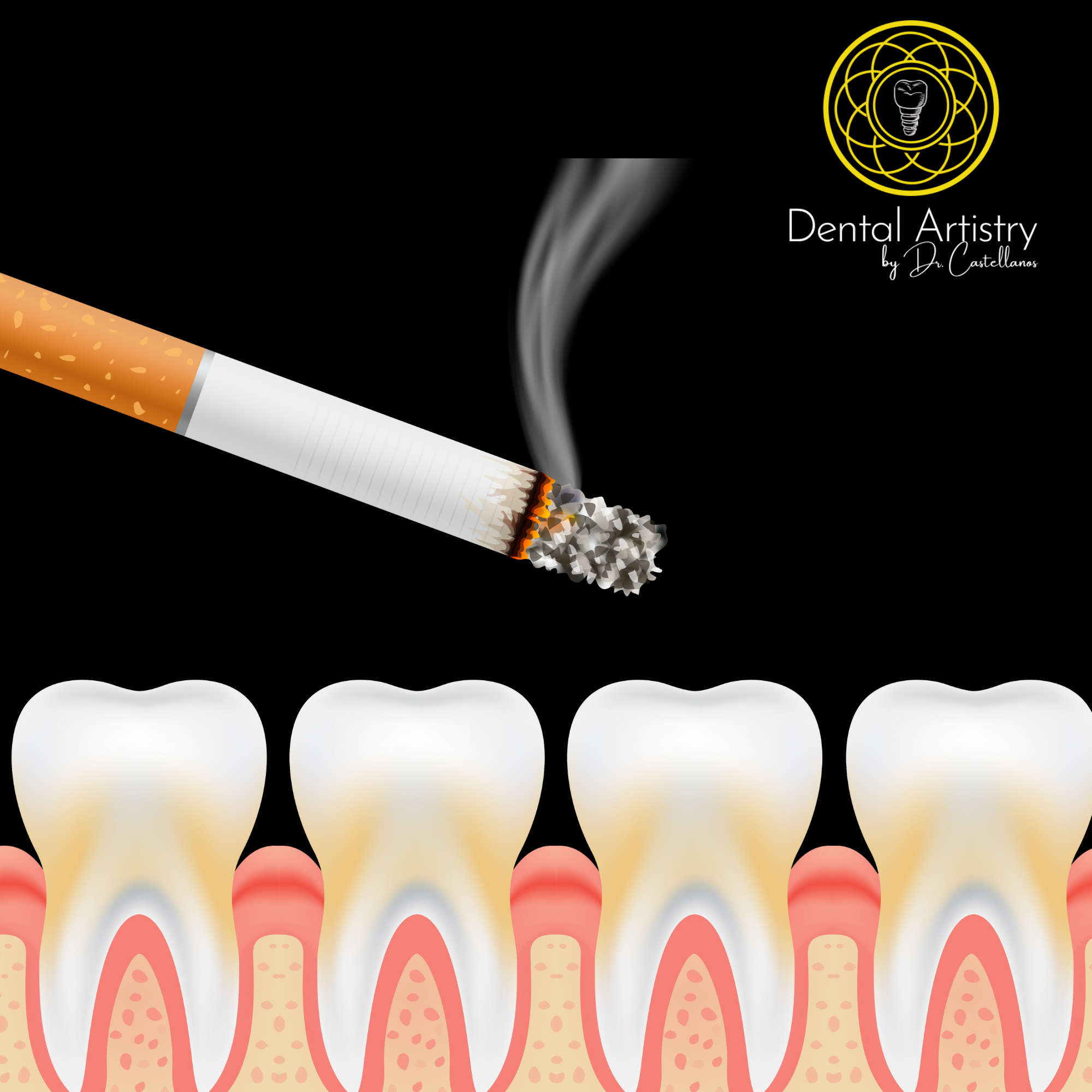 How Does Smoking Affect Your Gums and Teeth? | Dental Artistry MX ...