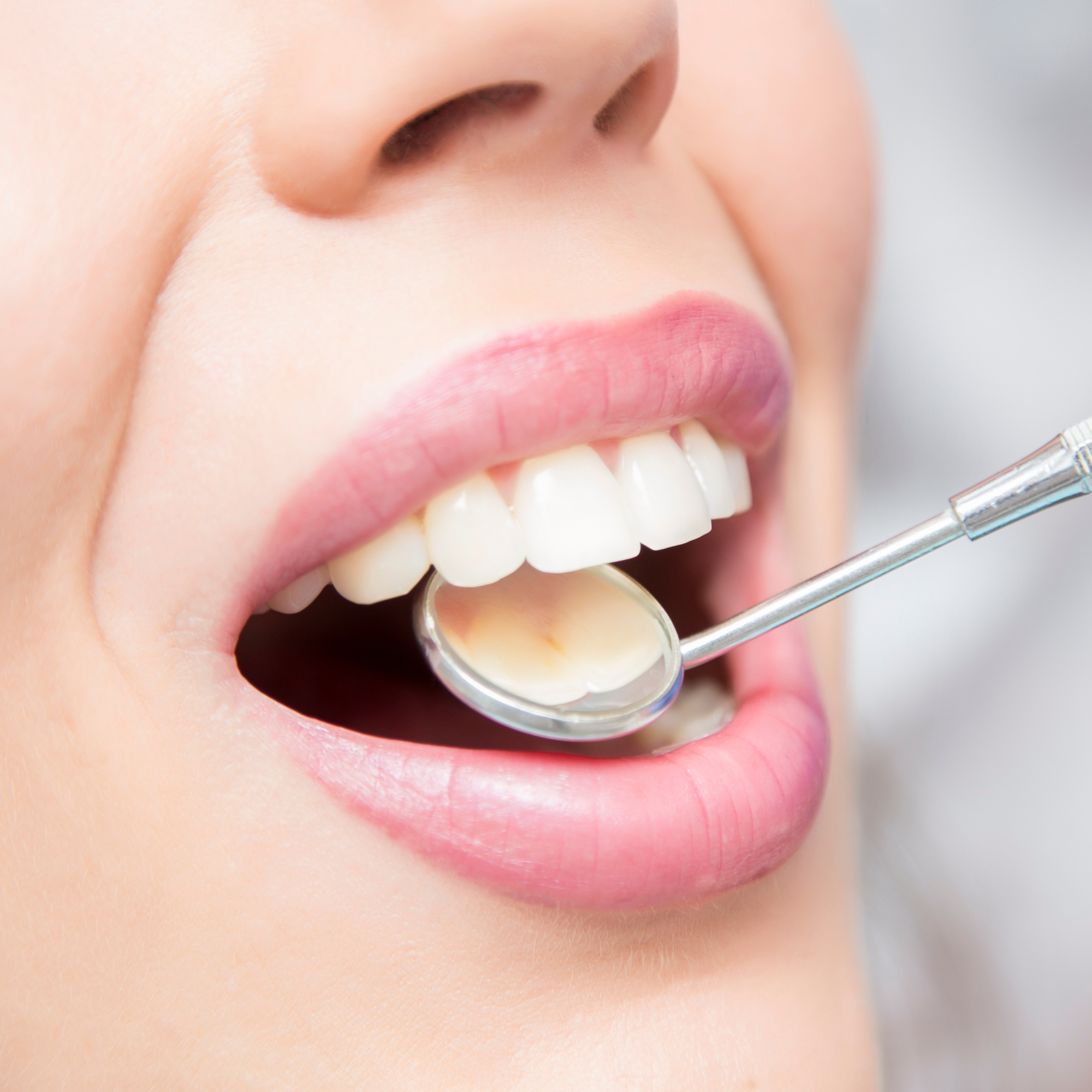 What Your Teeth Say About You — Beyond the Smile | Dental Artistry ...