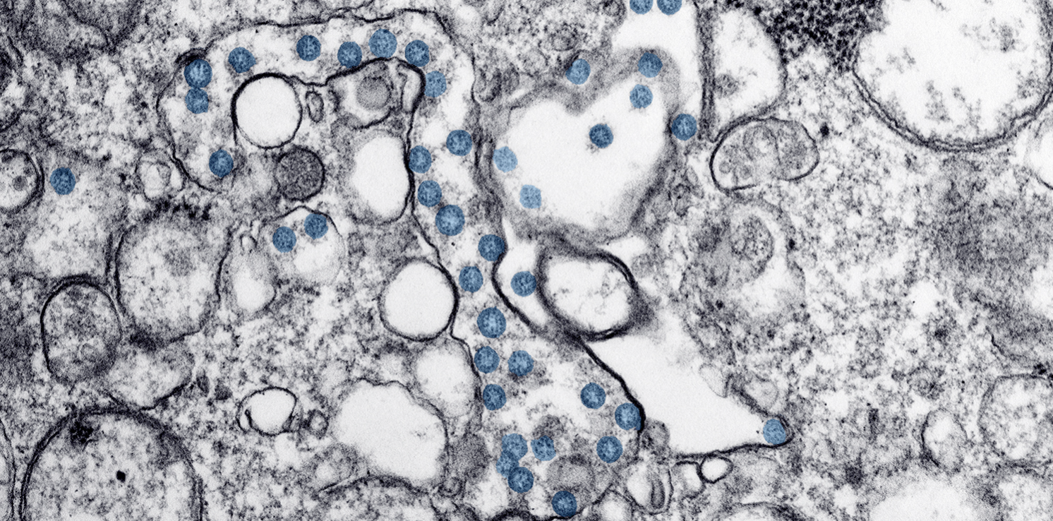 COVID-19: When to Discontinue Isolation?