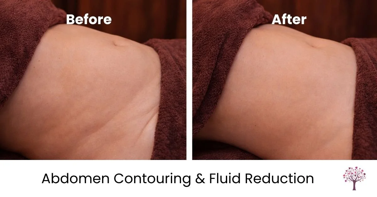 lymphatic massage for tummy contouring