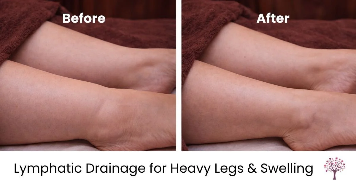 lymphatic massage for ankle swelling reduction