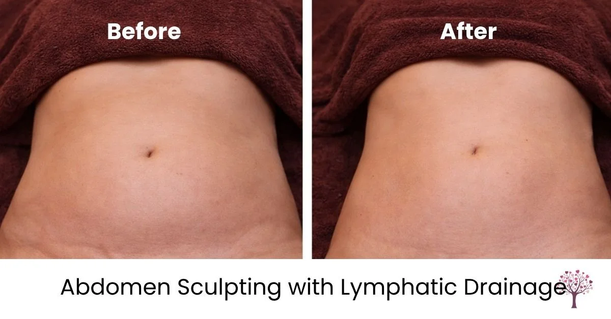 abdomen sculpting lymphatic massage