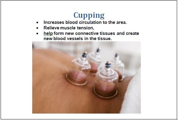 Cupping.png
