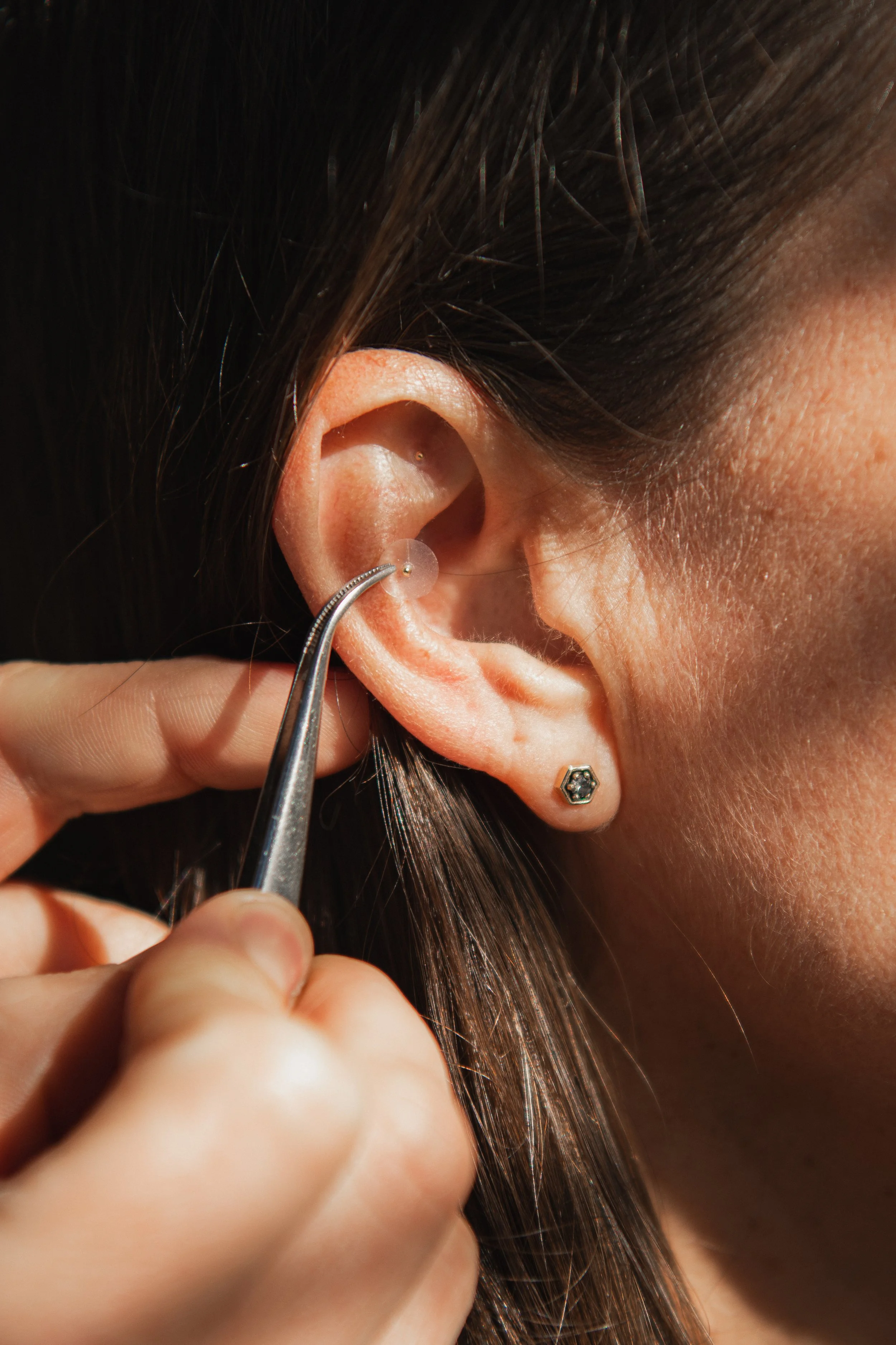Chinese Medicine acupressure therapy in Culver City