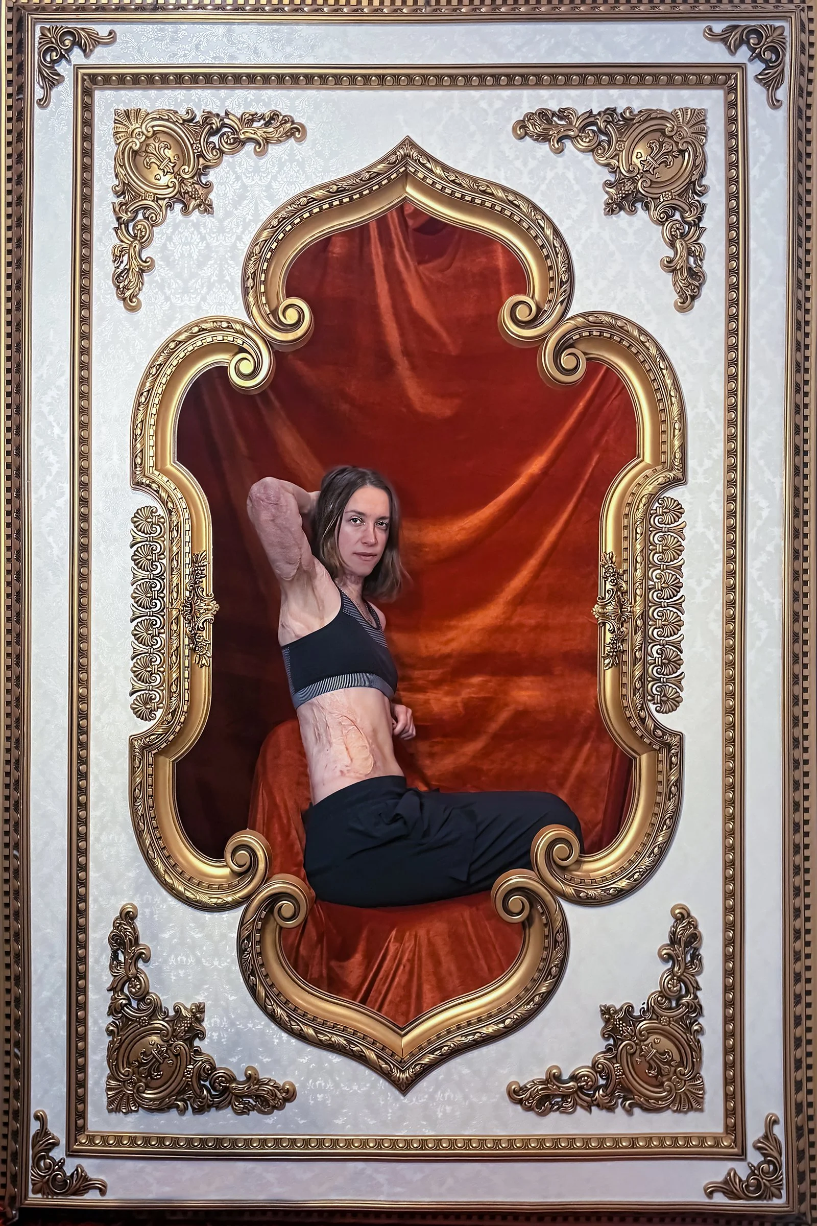 Emily - Burn Survivor: “ My scars as a burn survivor are beautiful and powerful and just make me “ME” now. I want other people to not feel sorry for me when they see me with these scars, but feel that I am just me, another person who made it through 