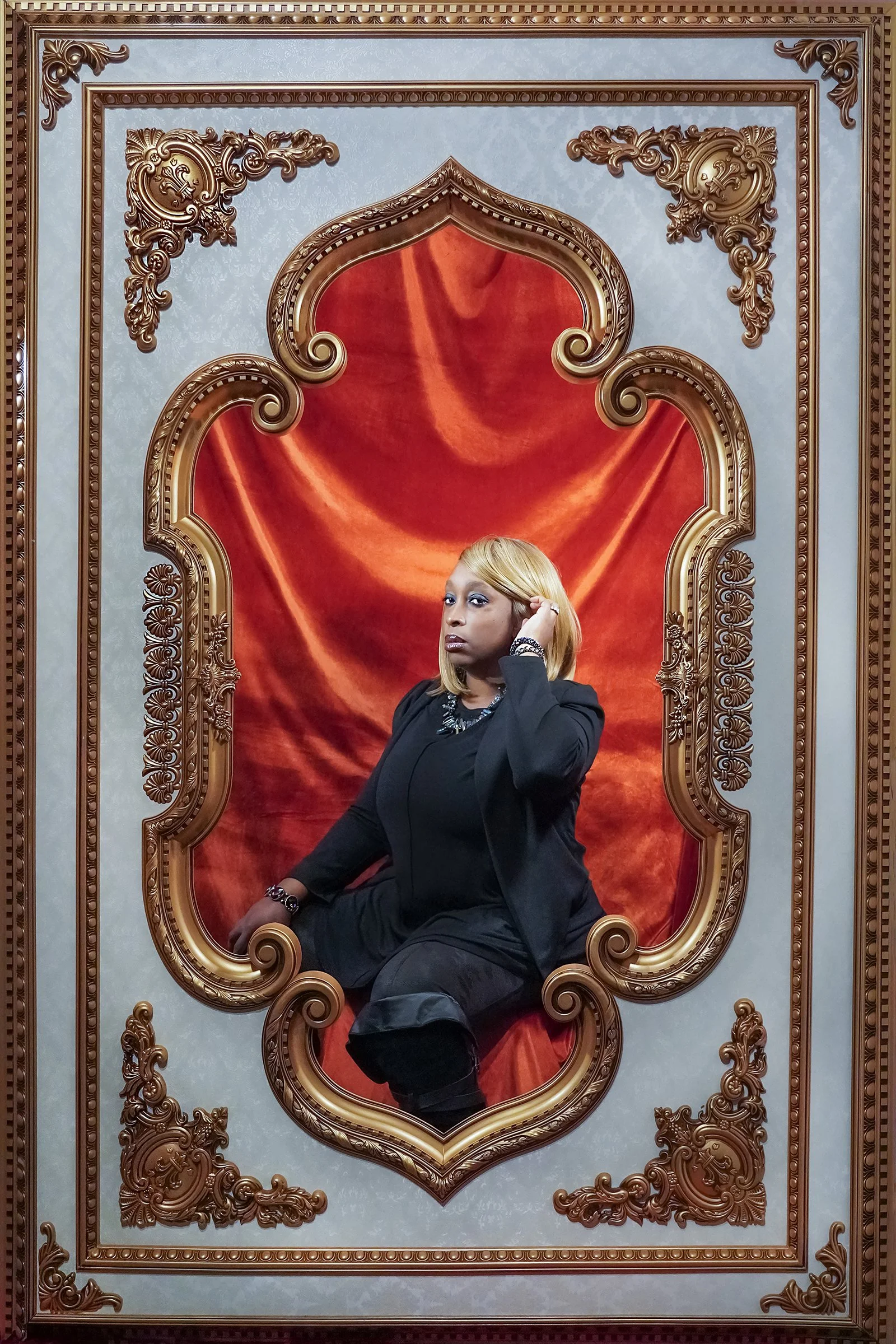 Shannon - Childhood Injury Scar: “ How I got my scar? Well from what I remembered I was being chase by one of my childhood friends who is no longer with us. I ended up colliding with my God brother and his bike and we both fell. I remember when I cam