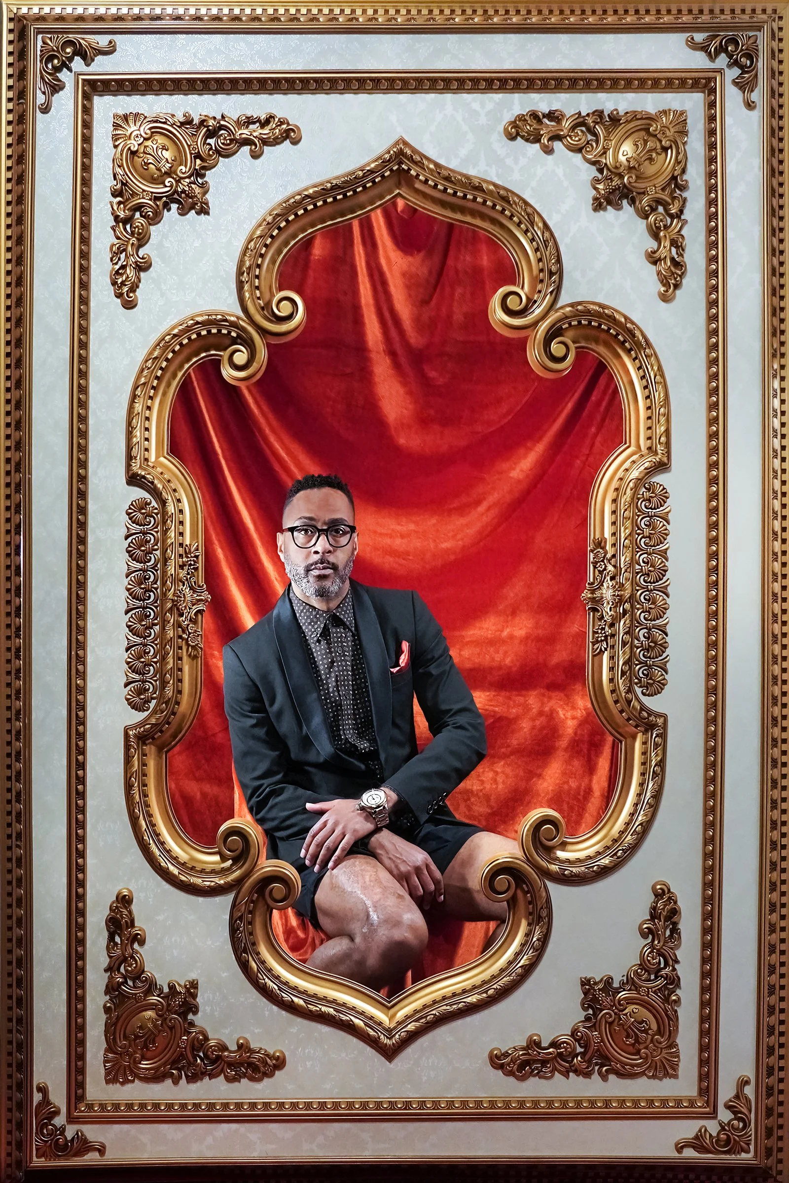 Curtis - Childhood Injury: “I was dragged along the right side of my body so I have a very visible leg scar above the knee of the right leg. It's been there since the age of 6. Growing up I was extremely insecure with it but through adult life I have