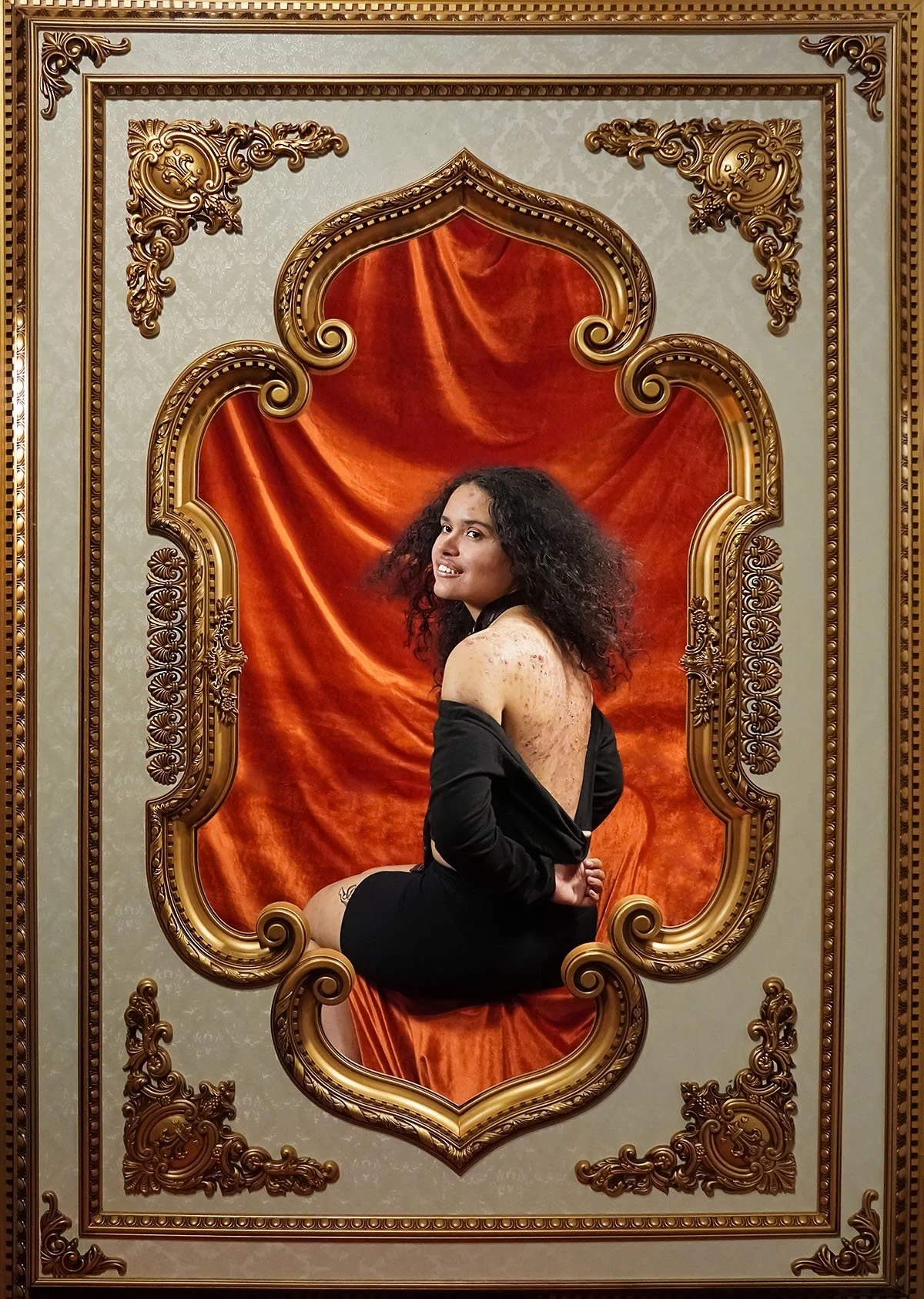 THE SKIN I'M IN: Breaking Beauty Barriers. Celebrating people with skin and body conditions.