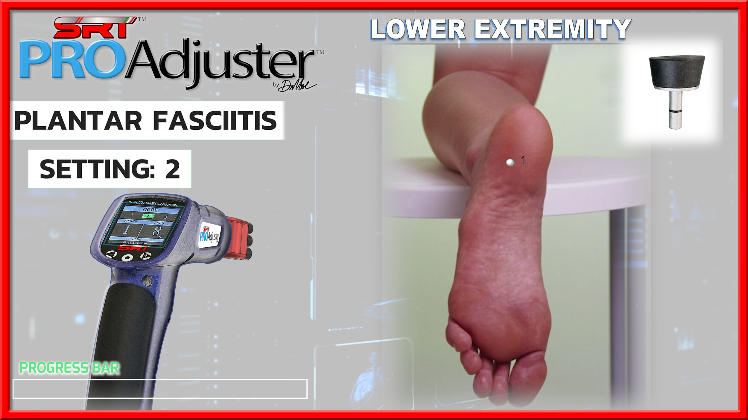 Plantar Fasciitis