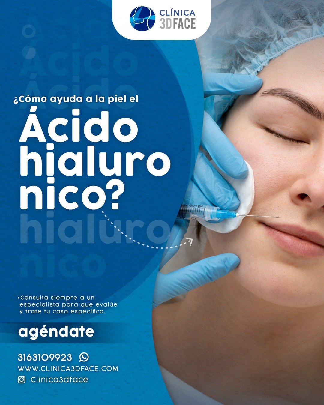 El &aacute;cido hialur&oacute;nico al ser capaz de actuar como una &ldquo;esponja&rdquo; para retener el agua en la piel, le aporta volumen y reduce visiblemente las arrugas, l&iacute;neas de expresi&oacute;n y revitaliza las capas superiores de la p