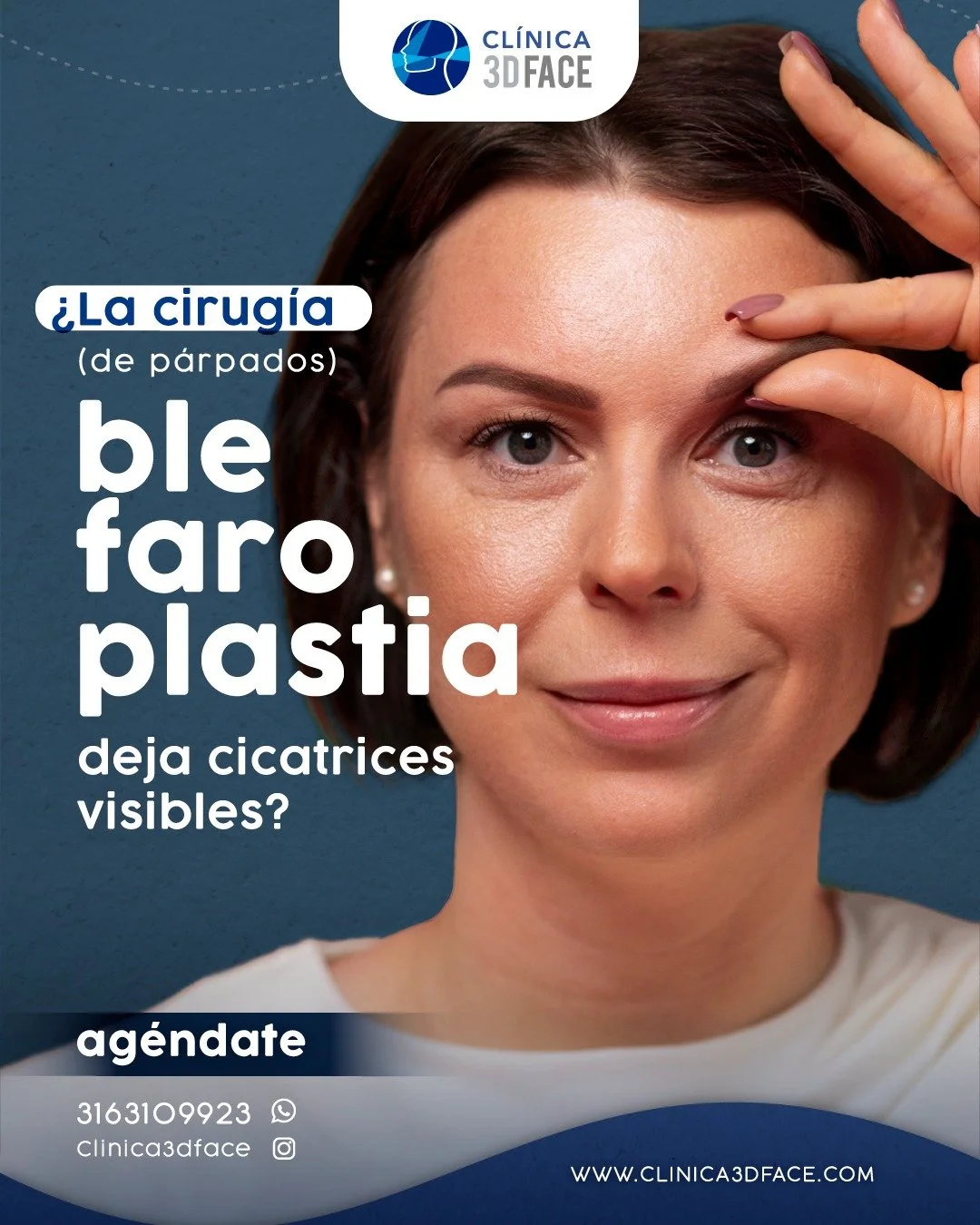 La blefaroplastia generalmente deja cicatrices m&iacute;nimas que son muy dif&iacute;ciles de detectar. Esto se debe a que las incisiones se realizan estrat&eacute;gicamente en los pliegues naturales de los p&aacute;rpados, donde quedan pr&aacute;cti