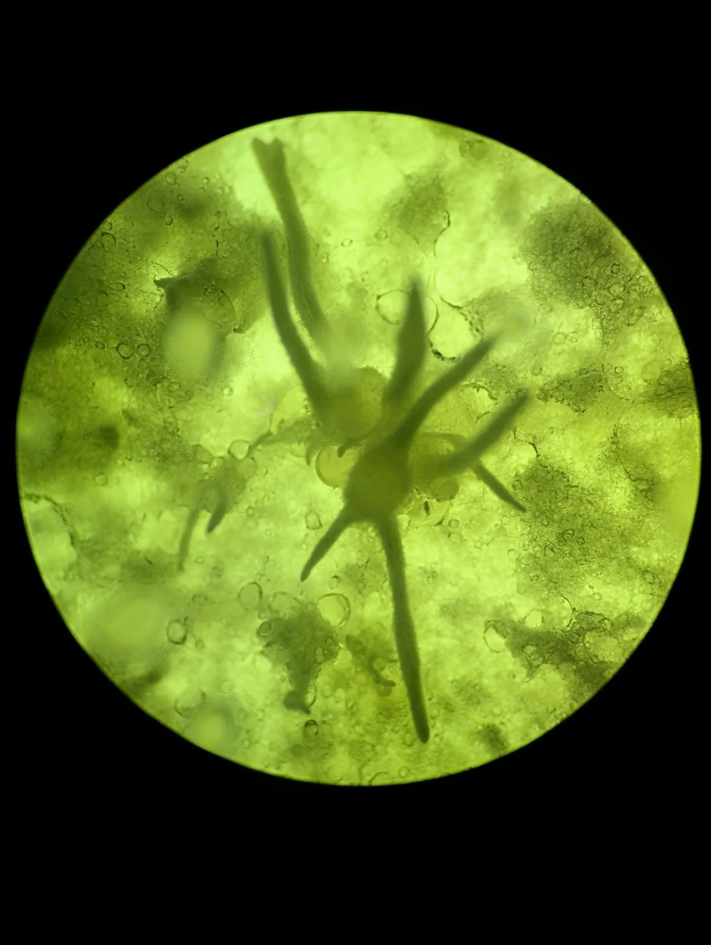 Through the Microscope - Images of Hericium americanum &amp; Ganoderma tsugae 🍄&zwj;🟫 
hi everyone! it's been a while... so I figured I would share some art from the lab and a little update! 
for those of you who don't know, I've been working in a 