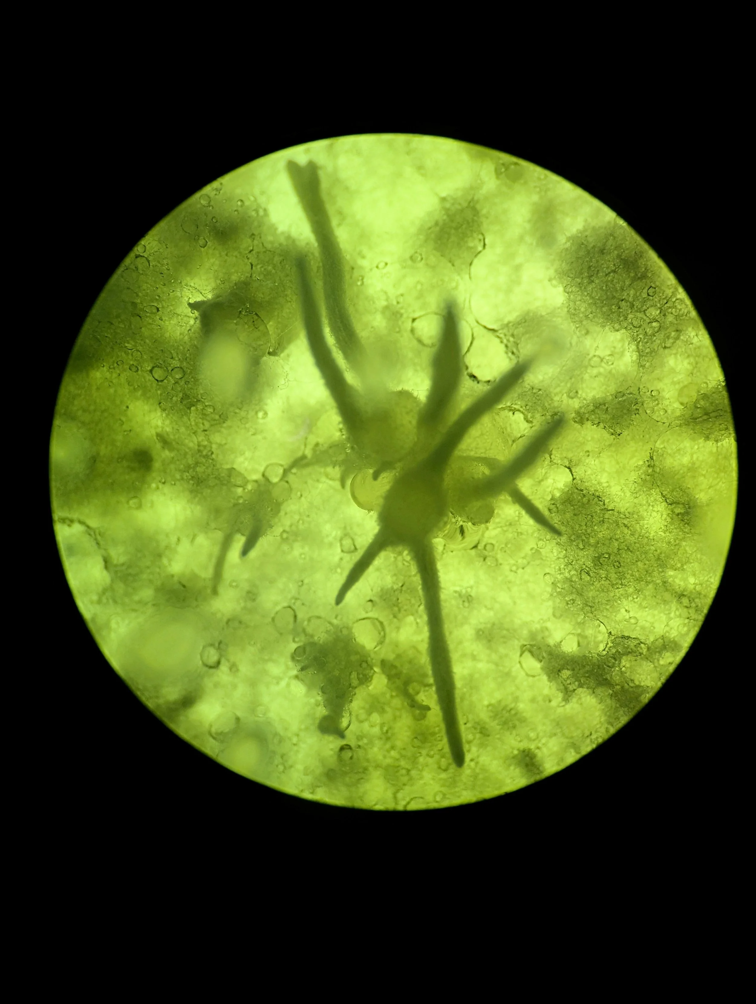 Light microscope image of Hericium americanum (Bear's head tooth fungus)