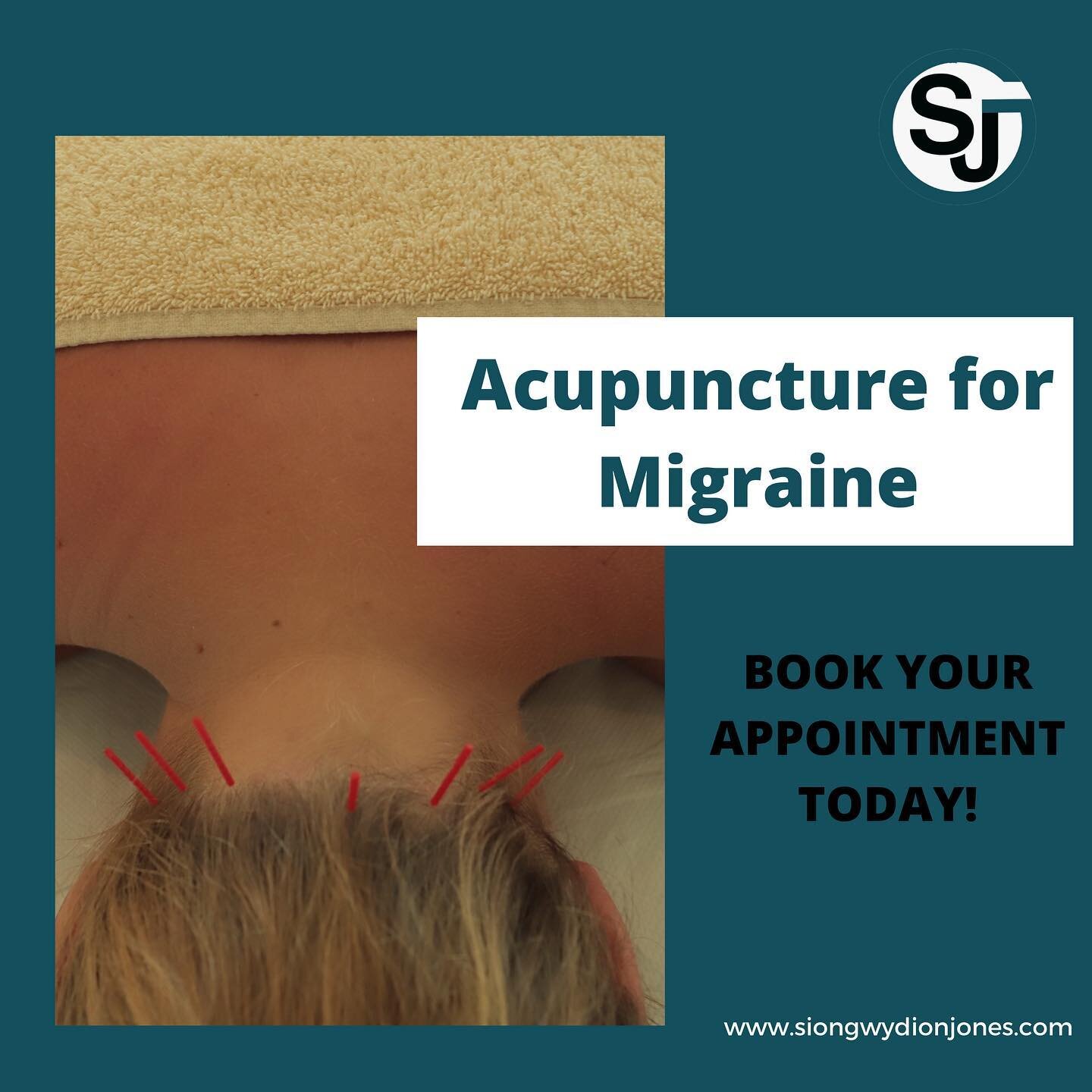Treating the suboccipital muscle group and the upper traps to help with migraines. The cause could vary from whiplash for a car accident to just poor posture in front of the computer. Either way don&rsquo;t keep suffering, tap on the Bio link and boo