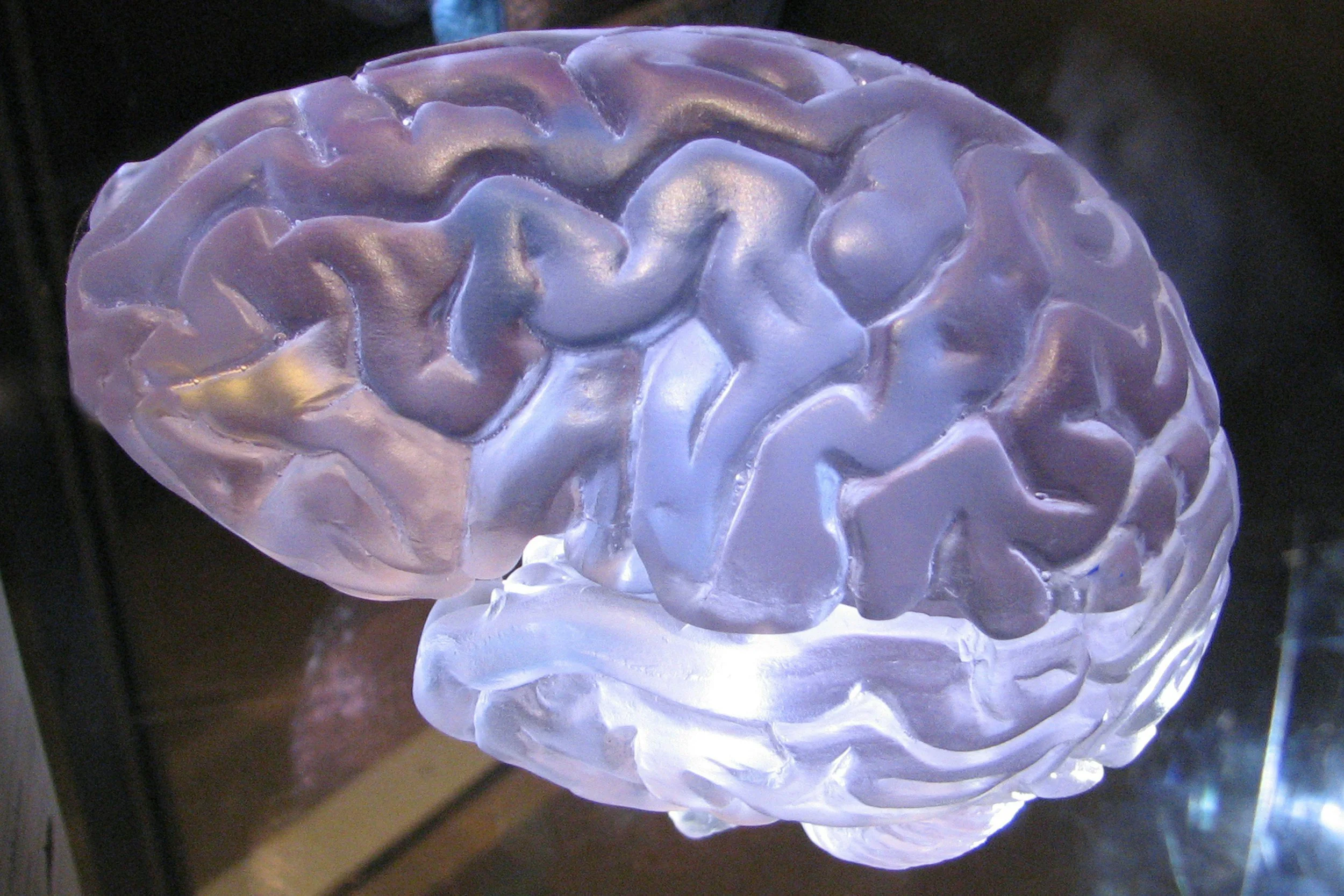 3D print of a brain. EMDR therapy for Trauma. EMDR therapy in Denver, CO. EMDR therapy in Philadelphia. EMDR therapy for anxiety. EMDR therapy for depression