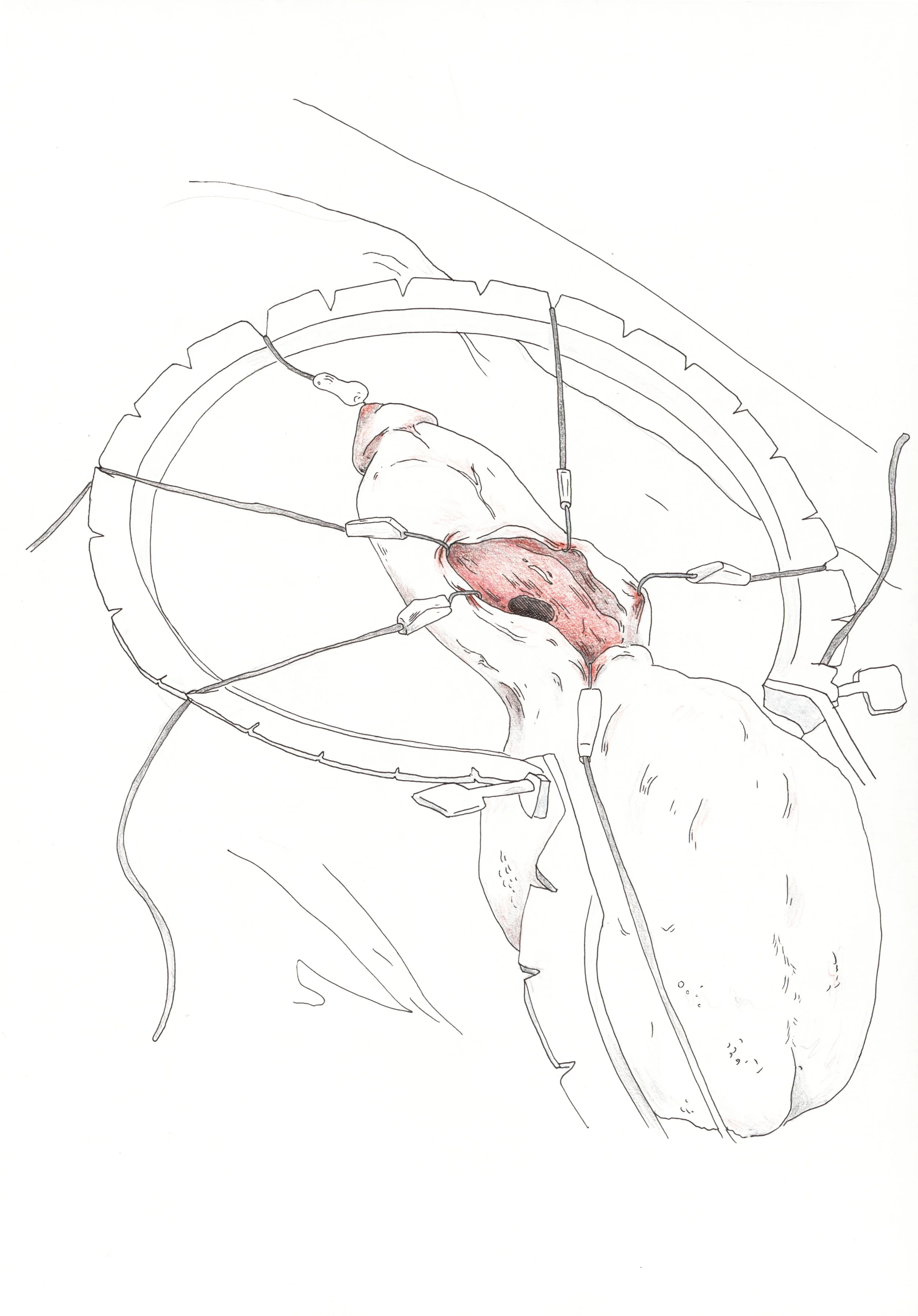Penis 10.jpg