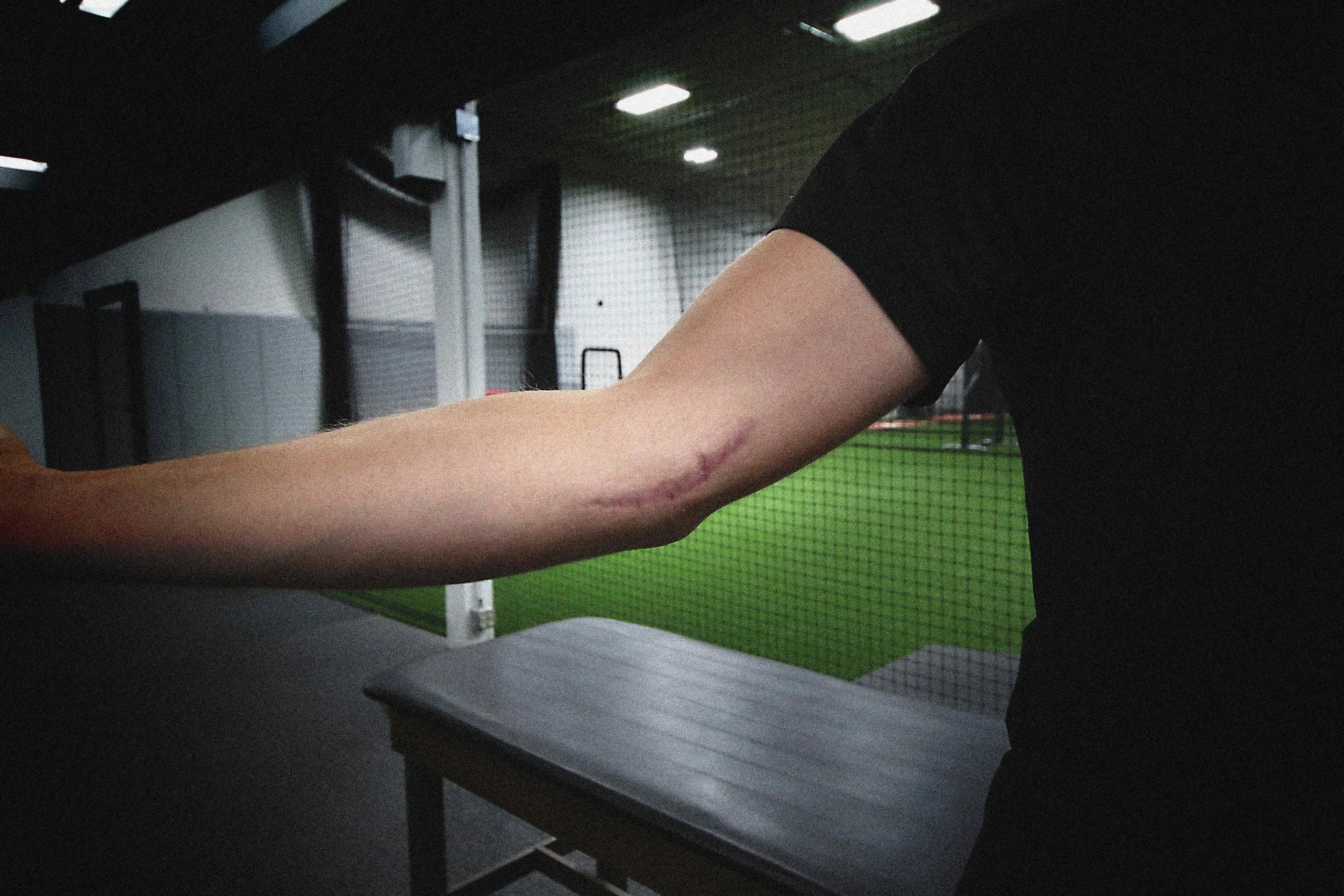 Physical Therapy — MVP Sports Rehab