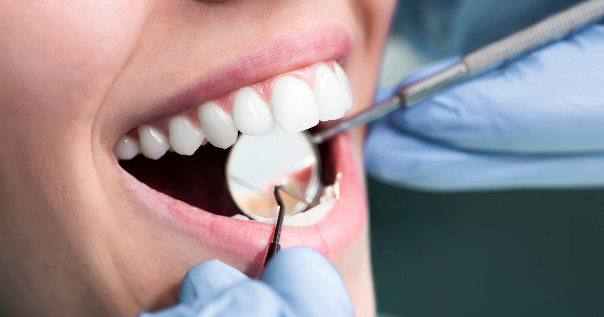 Preventive Dental Care: Everyday Habits for a Healthier Smile