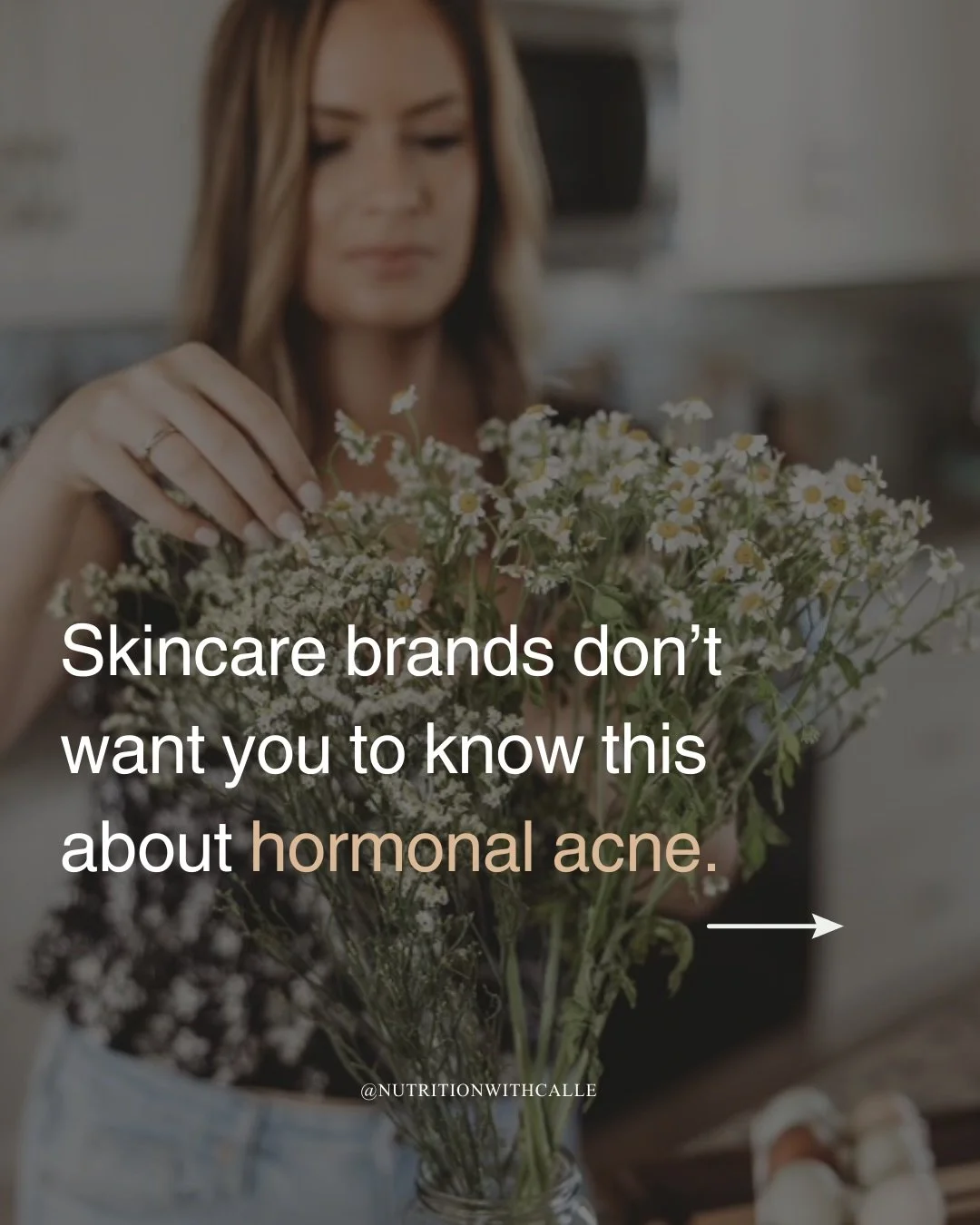 If acne were solved with: &bull; The right cleanser &bull; The right serum &bull; The right &ldquo;medical grade&rdquo; protocol

You wouldn&rsquo;t be here.

The average woman tries 6+ skincare products before exploring internal causes.

Because it 