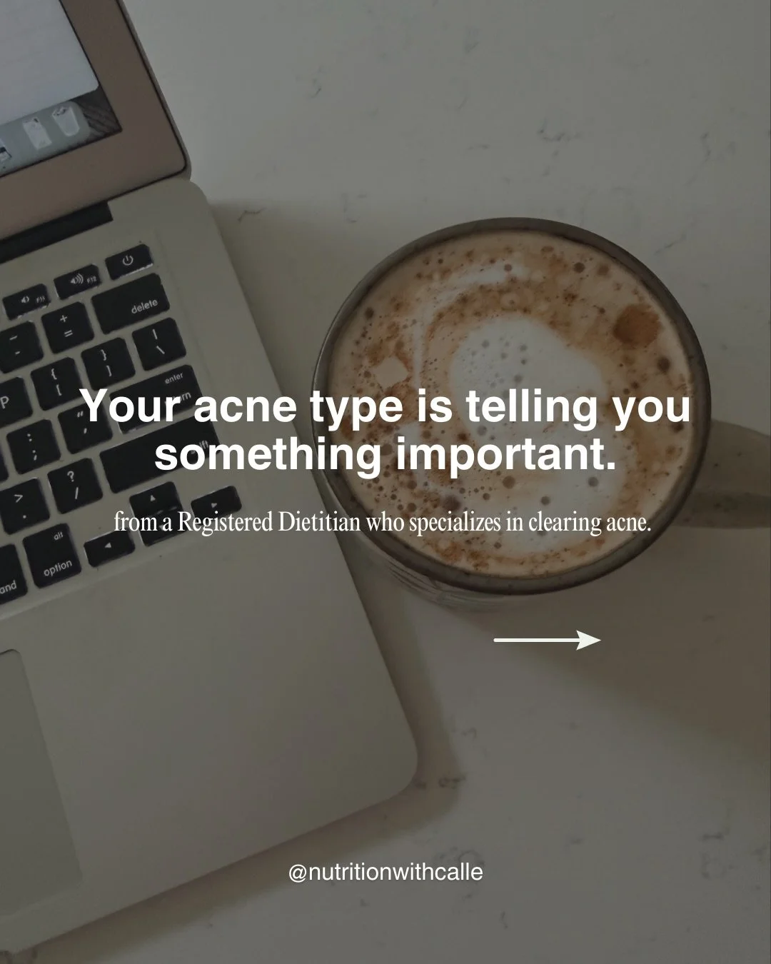 Most people are told their acne is &ldquo;just hormonal&rdquo;&hellip; and to take a medication, that&rsquo;s where the conversation ends.

So when you can&rsquo;t take the medication for whatever reason, you are left trying random supplements, cutti