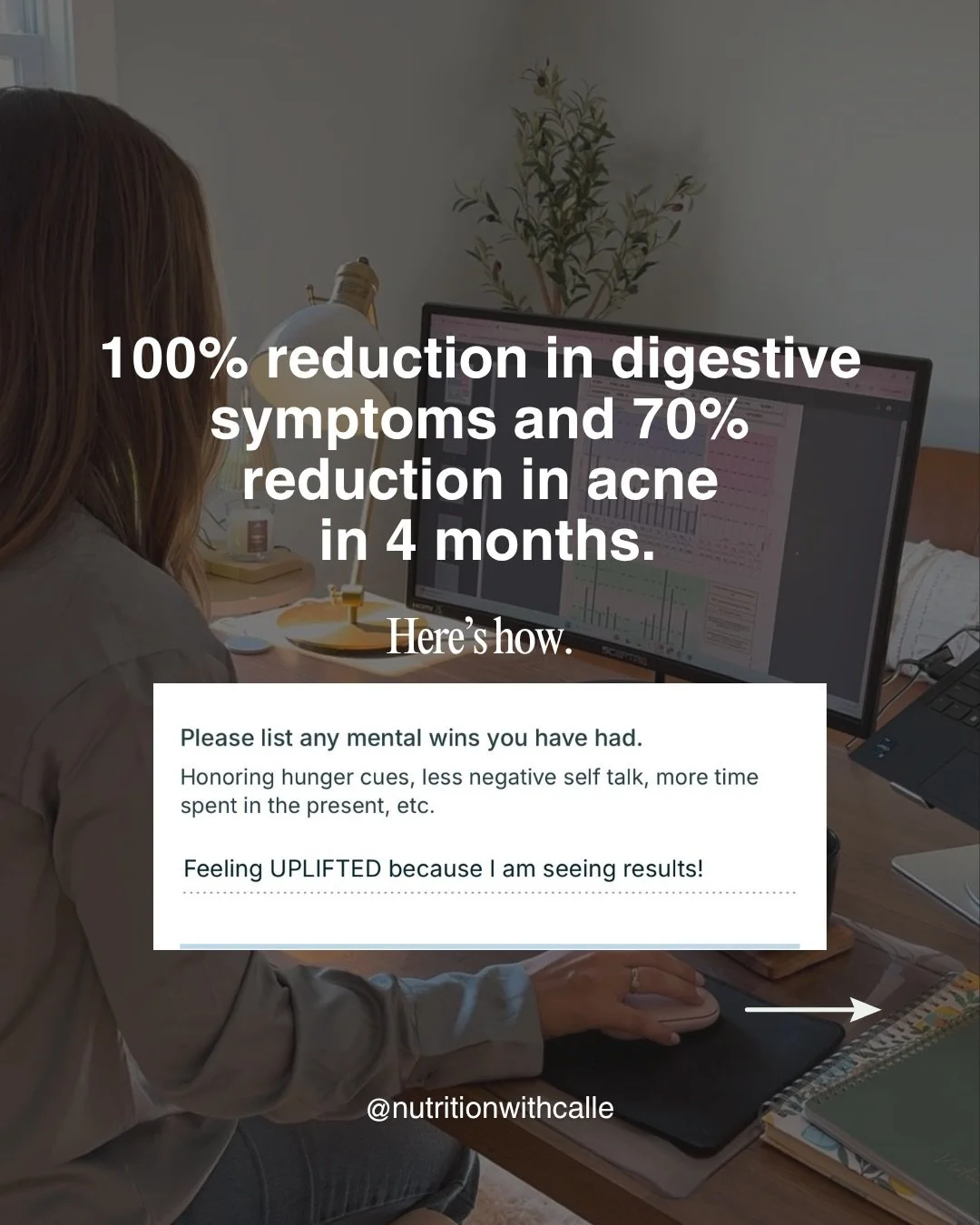 You&rsquo;re not getting answers like this about your acne.

Because most of what&rsquo;s out there is still:
&ldquo;heal your gut&rdquo;
&ldquo;eat clean&rdquo;
&ldquo;try cutting dairy&rdquo;

And while those things can matter&hellip; they&rsquo;re