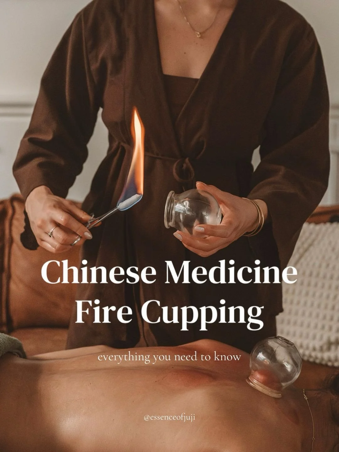 Many people see the marks and think it&rsquo;s &ldquo;just bruising,&rdquo; but in reality, cupping is a therapeutic tool that moves stuck Qi and Blood, releases tension, and supports the nervous system.

From pain relief to stress reduction, digesti