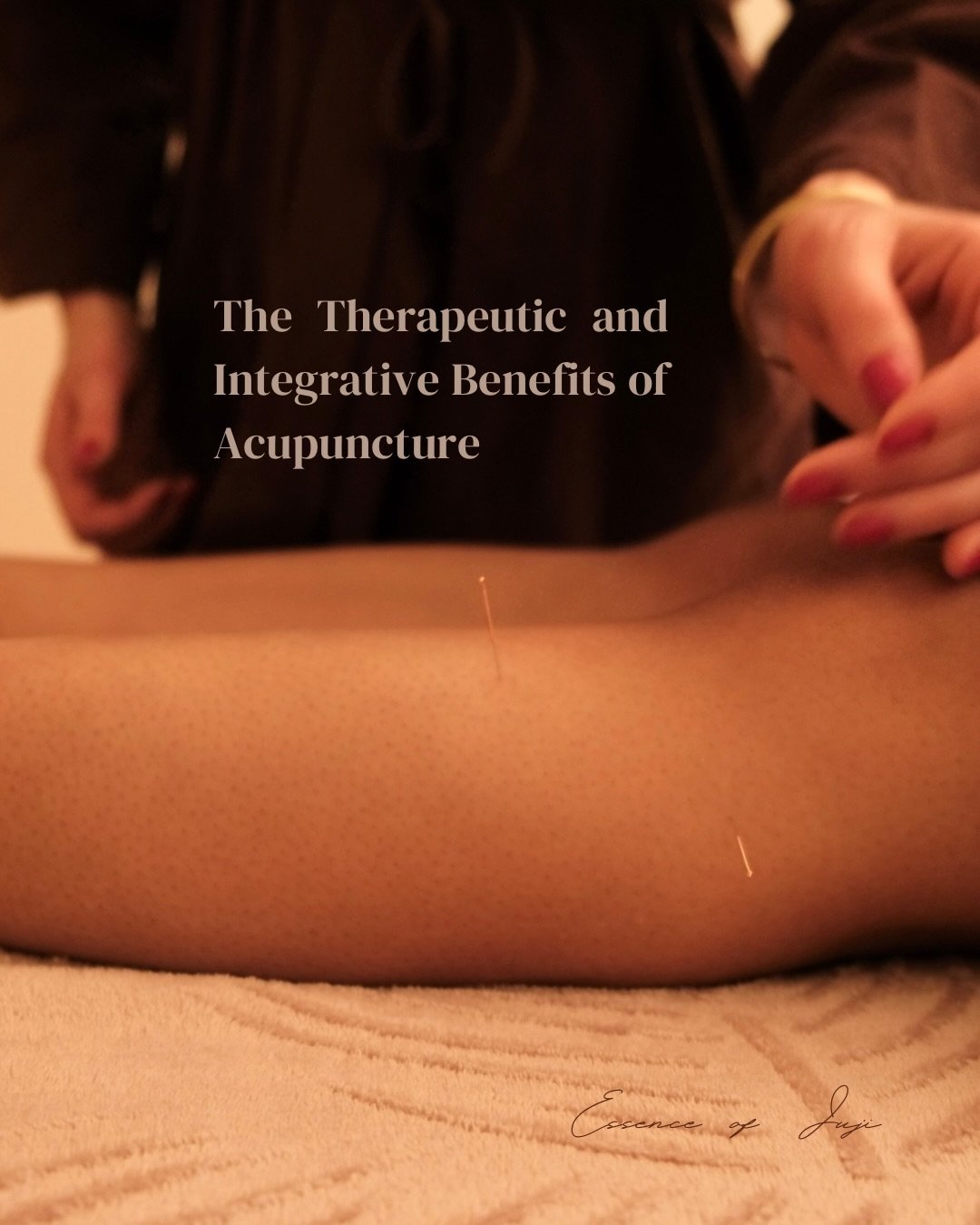 Acupuncture is far more than a tool for symptom relief &mdash; it is a sophisticated, holistic system that nurtures the body, mind, and spirit 🤎

Rooted in Chinese medicine, frequent acupuncture treatments regulate physiological function, modulate t