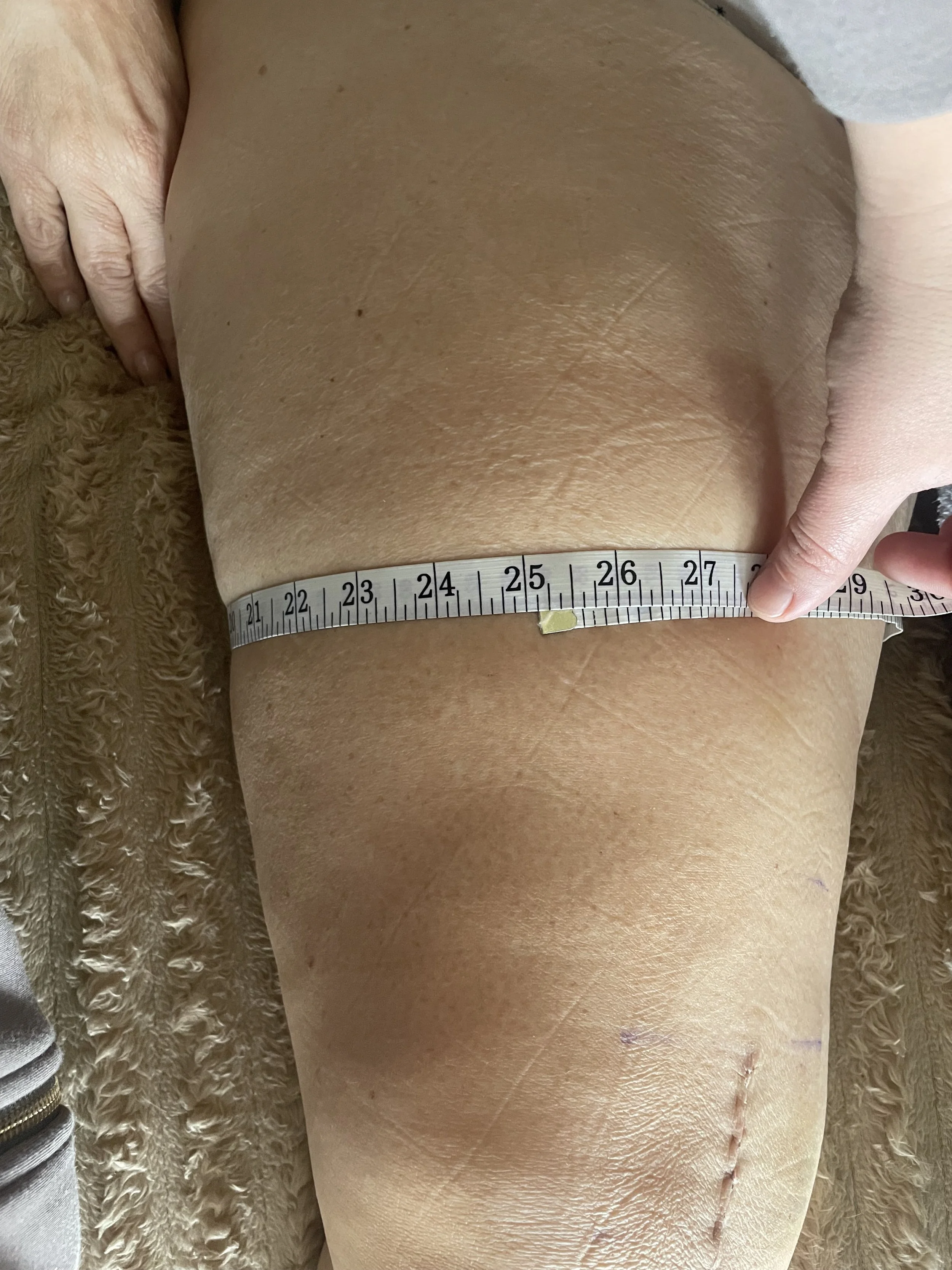 After Mid Thigh 