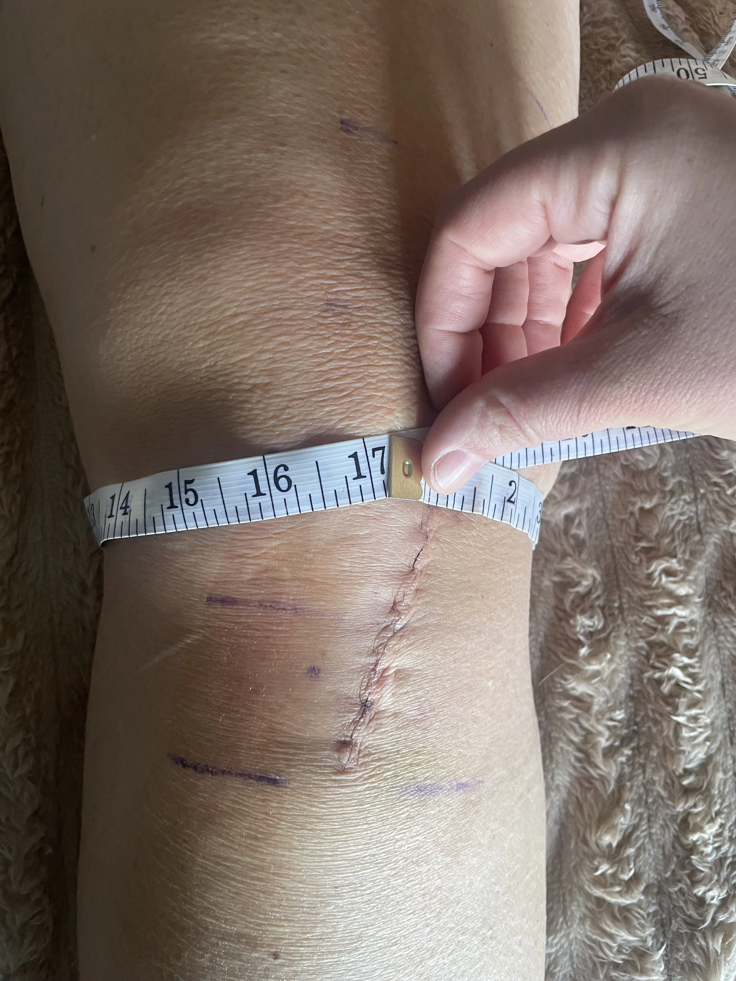 After Above Knee