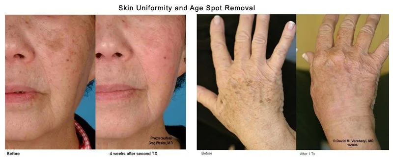 Pigment before n after.jpg