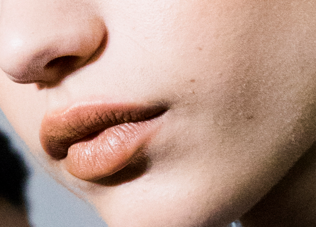 lip-filler-reactions-1024x736.png