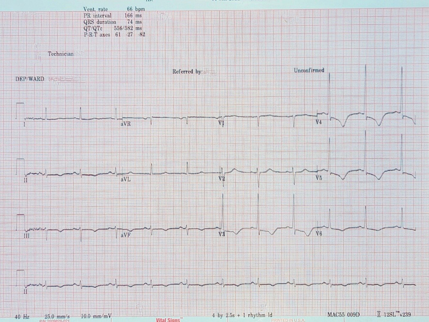 ECG - long QT