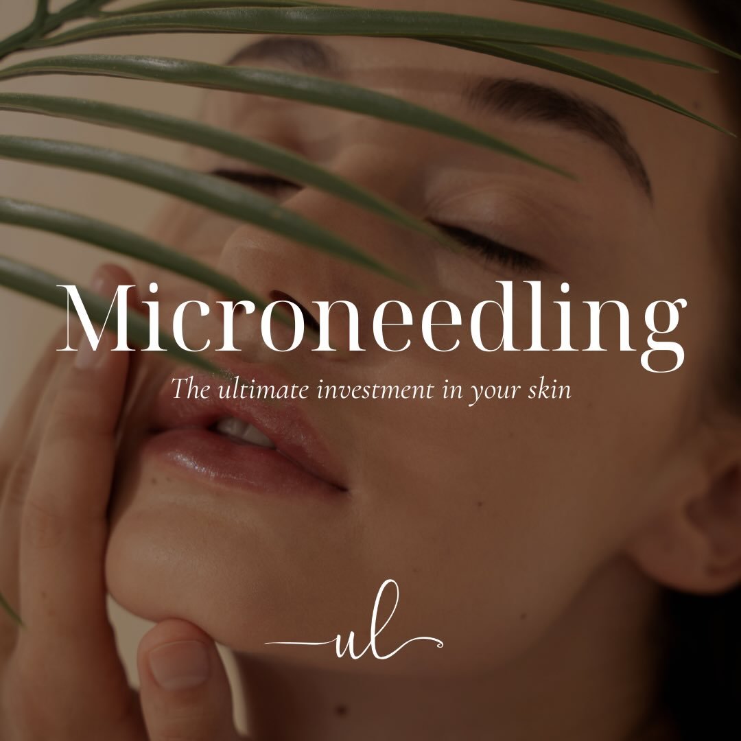 Microneedling: the ultimate investment in your skin ✨ 

So what is microneedling?
Microneedling is a medical-grade treatment that uses tiny, controlled micro-channels in the skin to stimulate your body&rsquo;s natural collagen and elastin production.