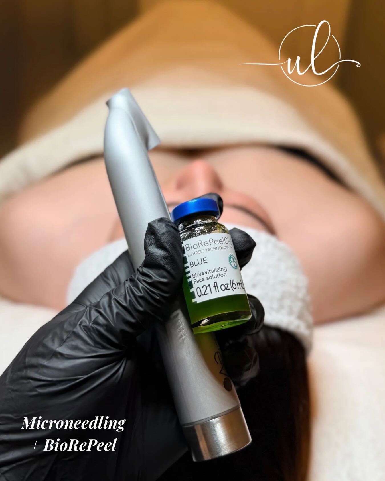 This duo is a no-brainer! Microneedling &amp; BioRePeel work to amplify the results of each treatment, enhancing your results.

✨ Wrinkle reversing
✨ Improves acne &amp; dark spots
✨ Smooths texture
✨ Boosts cell turnover
✨ NO downtime, short healing