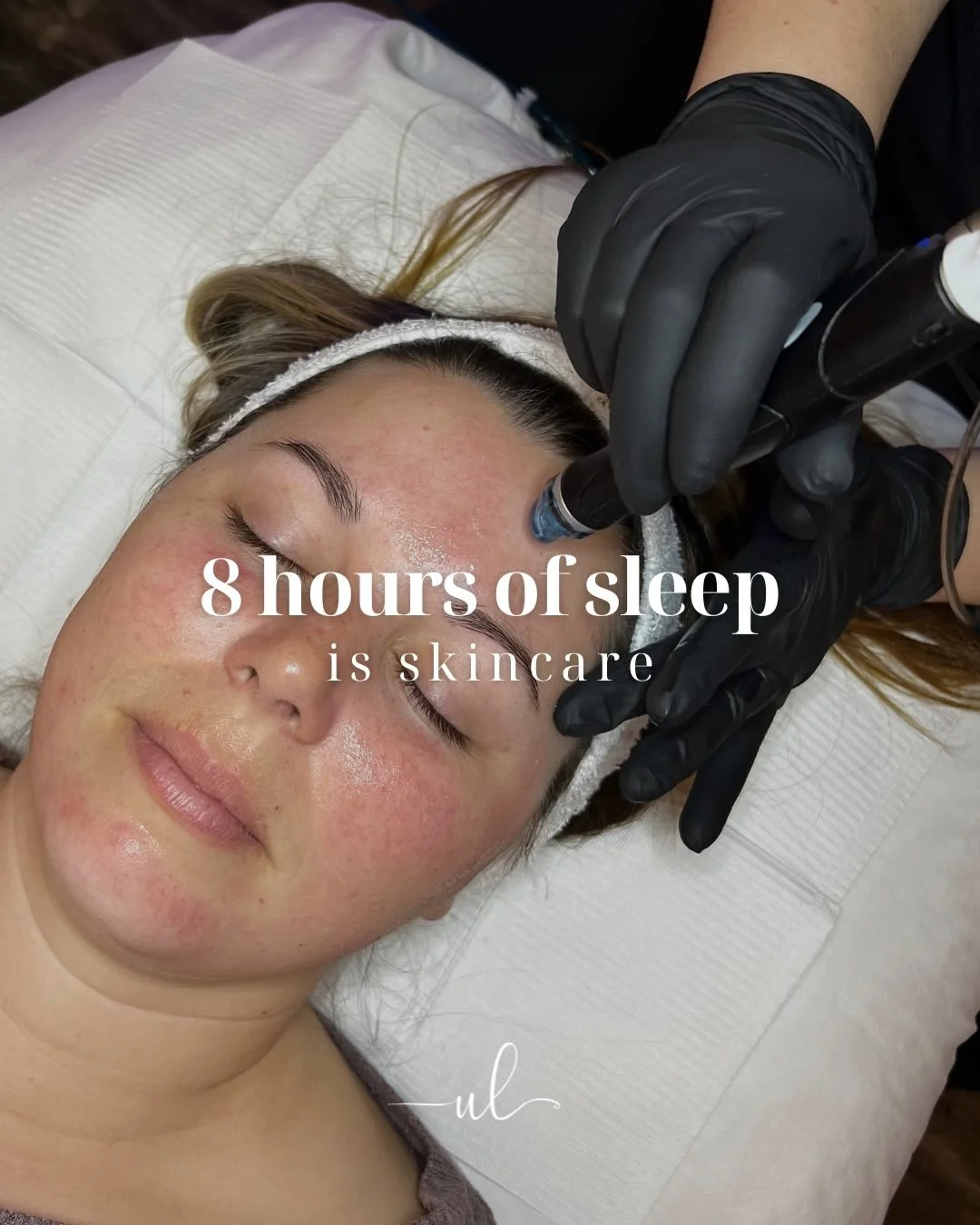 POV: You realize your skin often reflects what&rsquo;s happening beneath the surface ✨ 

😴 8 hours of sleep is skincare
Your skin repairs, regenerates and recovers while you sleep.

💧 Staying hydrated is skincare
Healthy, radiant skin starts from w