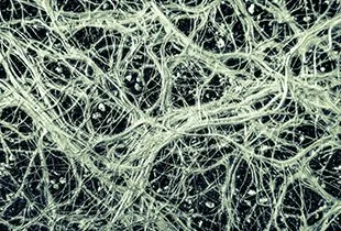 The supportive social network of the trees: Insights into the Wood Wide Web