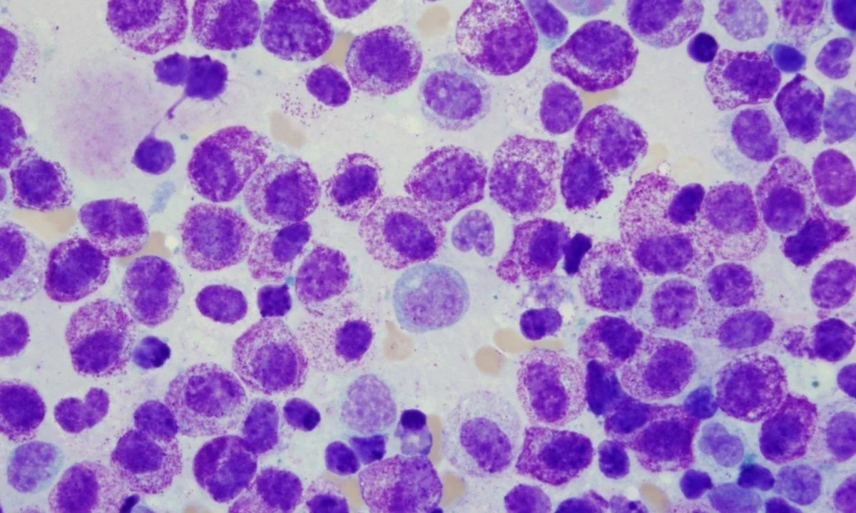 A Guide for MCAS (Mast Cell Activation Syndrome)