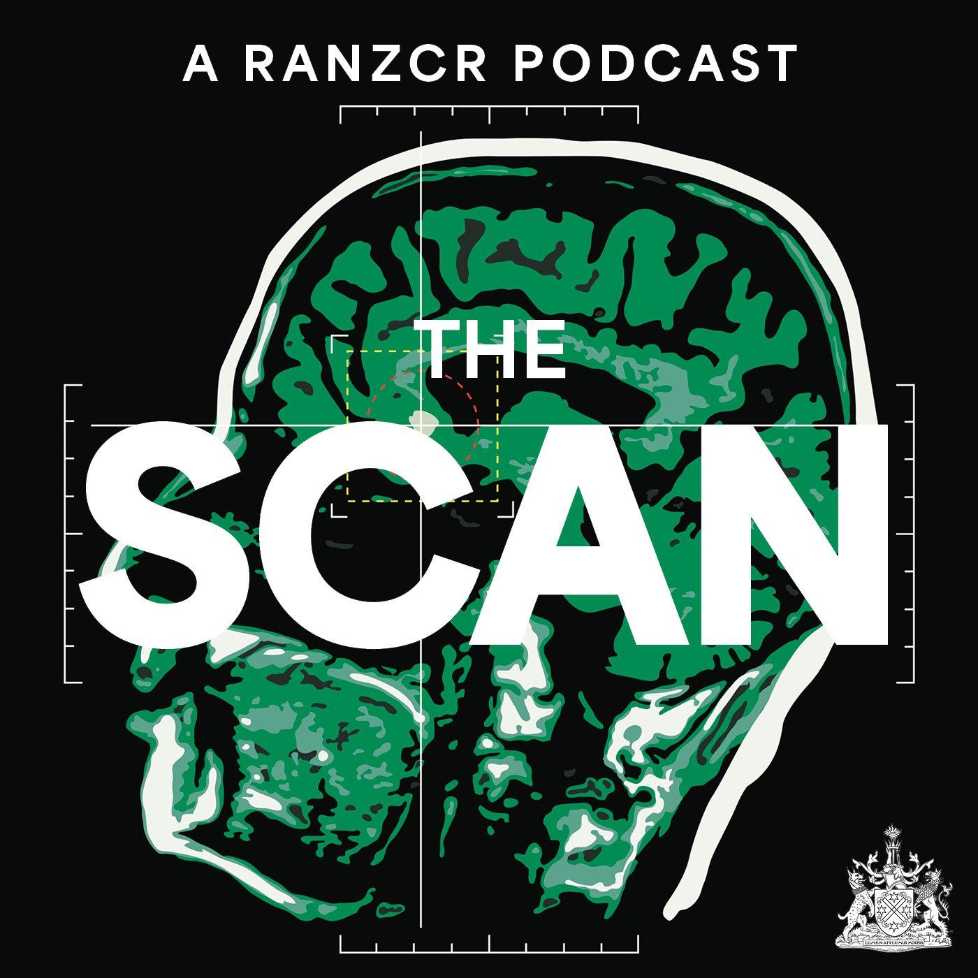 The Scan.jpg
