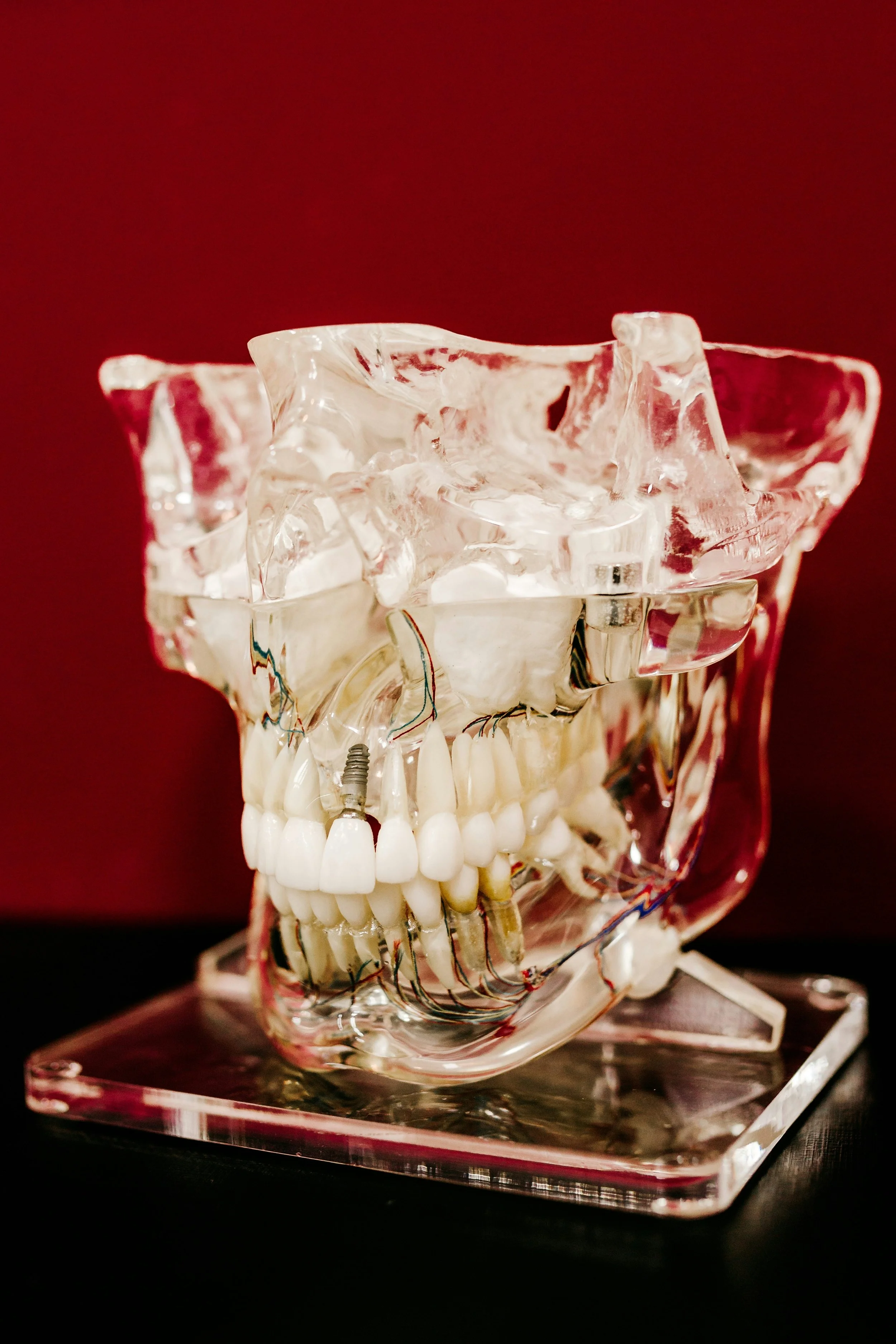 Dental Implants 101: The Permanent Solution to Tooth Loss