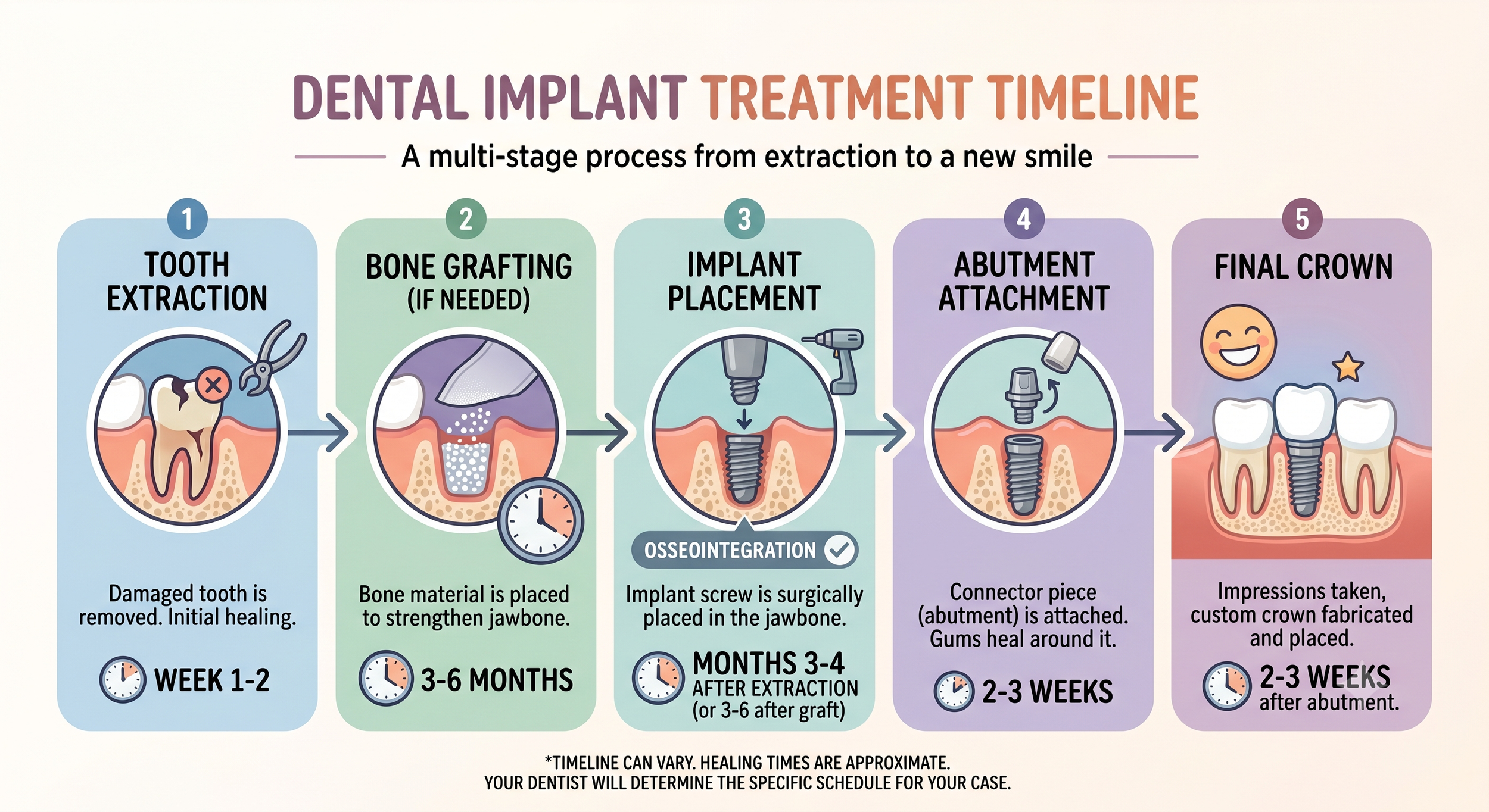 Dental Implants in Boston: A Complete Guide. 波士頓植牙完整指南