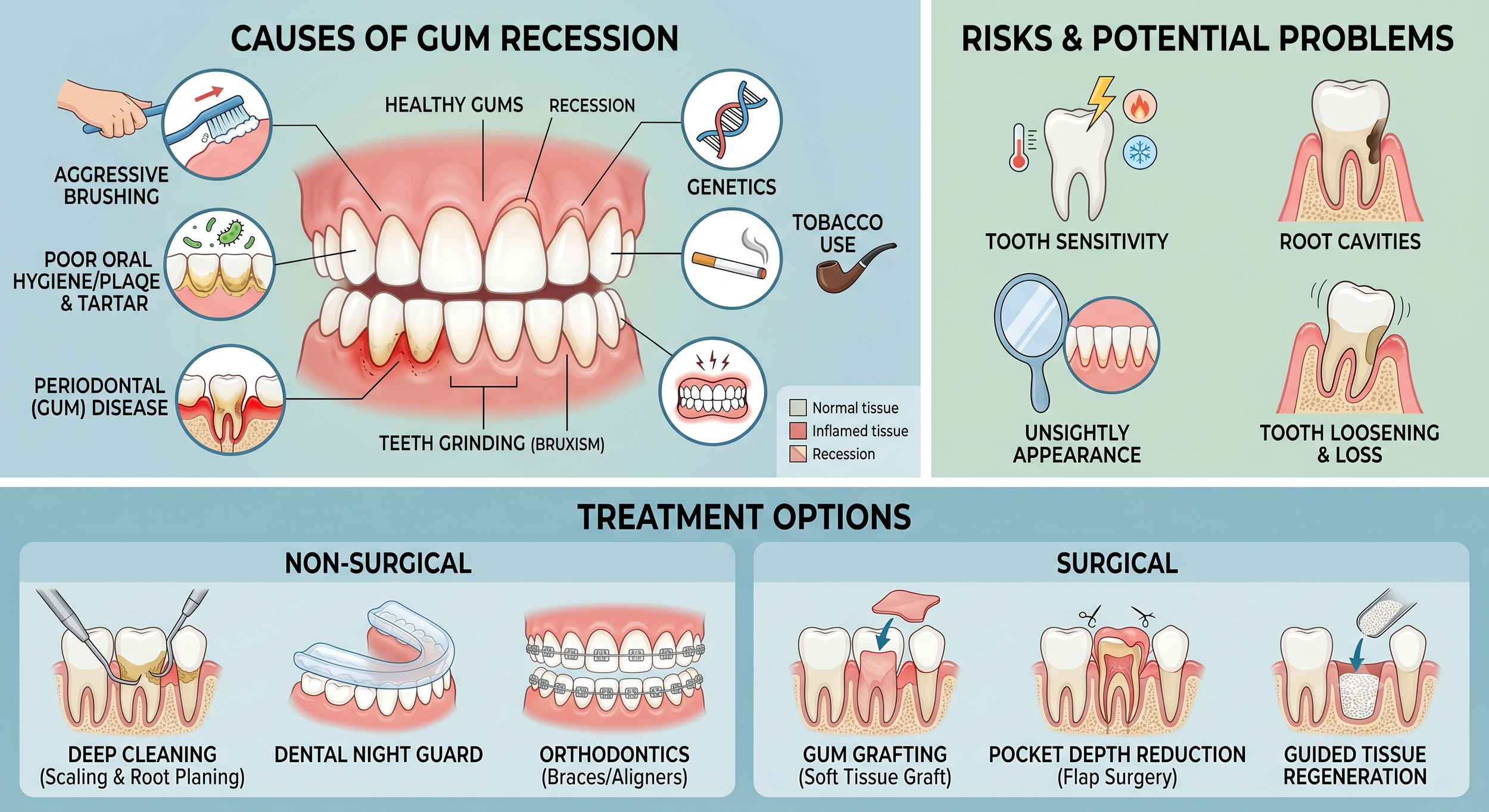 Gum Recession: Causes, Risks, and Treatment Options 牙齦萎縮：原因、風險和治療選擇